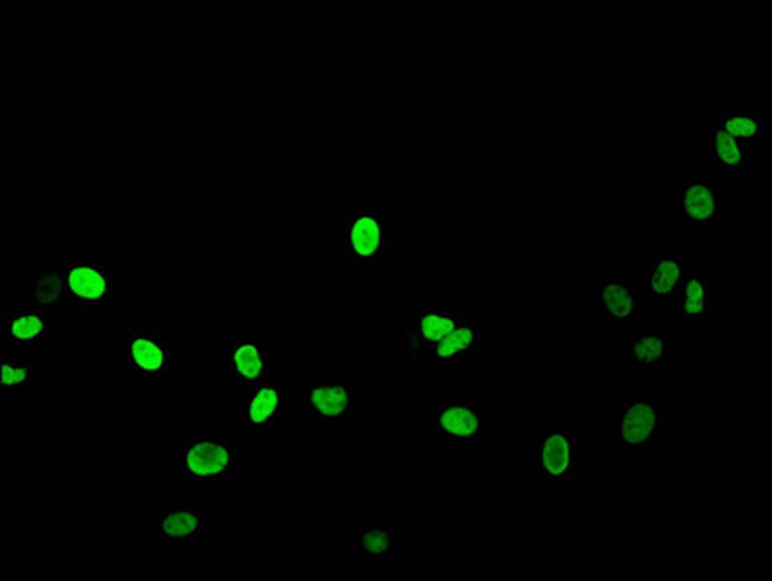 Immunofluorescent analysis of HepG2 cells (sodium butyrate, 30 mM, 4h) using CSB-PA010377PA16acHU at dilution of 1:100 and Alexa Fluor 488-congugated AffiniPure Goat Anti-Rabbit IgG(H+L)