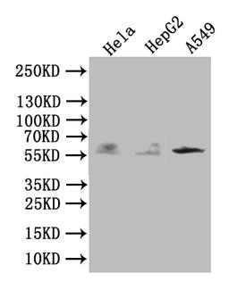 Western Blot. Positive WB detected in: MCF-7 whole cell lysate, Hela whole cell lysate, A549 whole cell lysate, Rat brain tissue, Rat heart tissue. All lanes: TRIM4 antibody at 3.4ug/ml. Secondary. Goat polyclonal to rabbit IgG at 1/50000 dilution. Predicted band size: 58, 55, 35 kDa. Observed band size: 55, 62, 35, 90 kDa. 