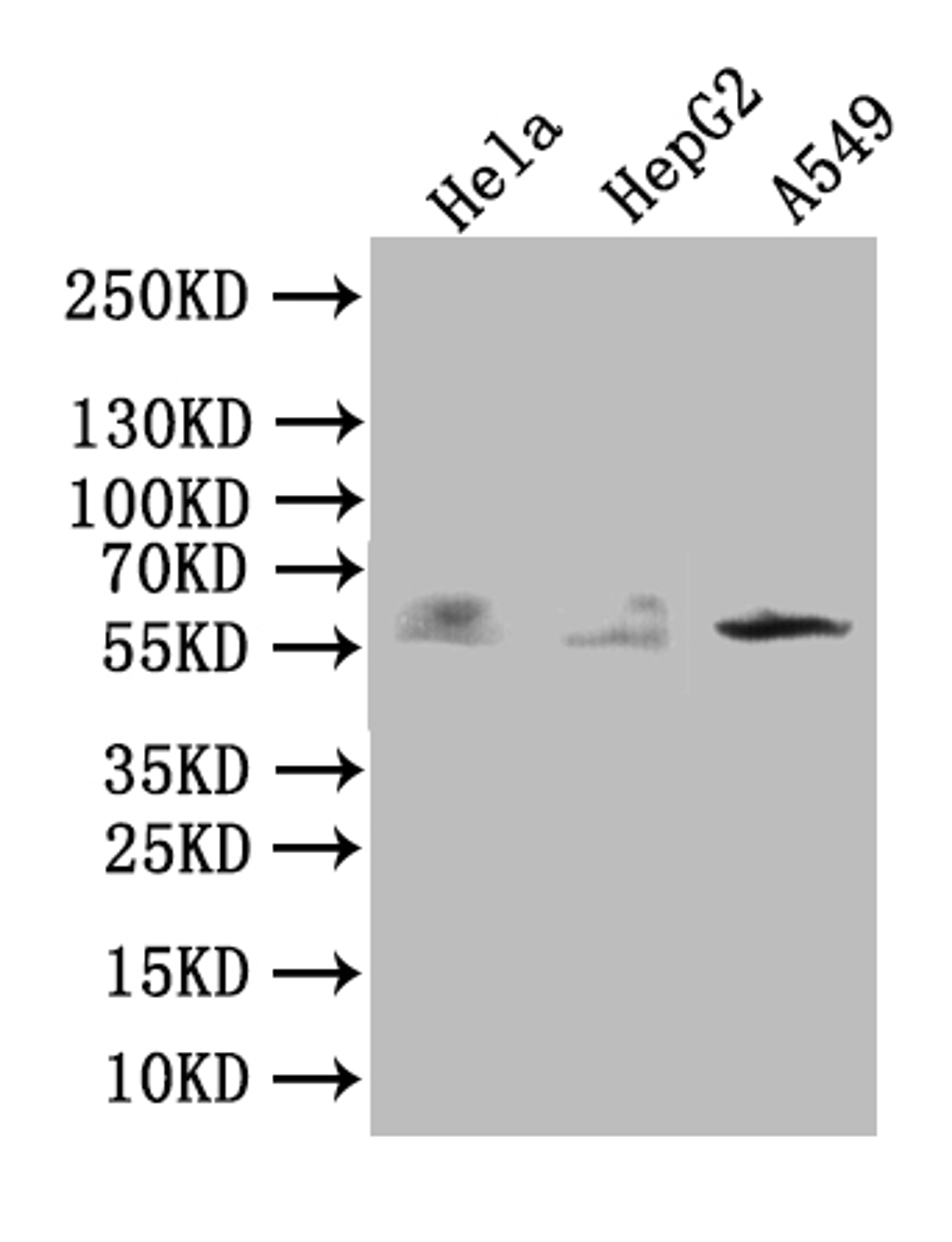 Western Blot. Positive WB detected in: MCF-7 whole cell lysate, Hela whole cell lysate, A549 whole cell lysate, Rat brain tissue, Rat heart tissue. All lanes: TRIM4 antibody at 3.4ug/ml. Secondary. Goat polyclonal to rabbit IgG at 1/50000 dilution. Predicted band size: 58, 55, 35 kDa. Observed band size: 55, 62, 35, 90 kDa. 