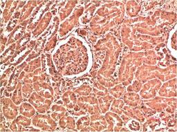 Immunohistochemical analysis of paraffin-embedded Human Kidney Tissue using Collagen IV  Mouse mAb diluted at 1:200.
