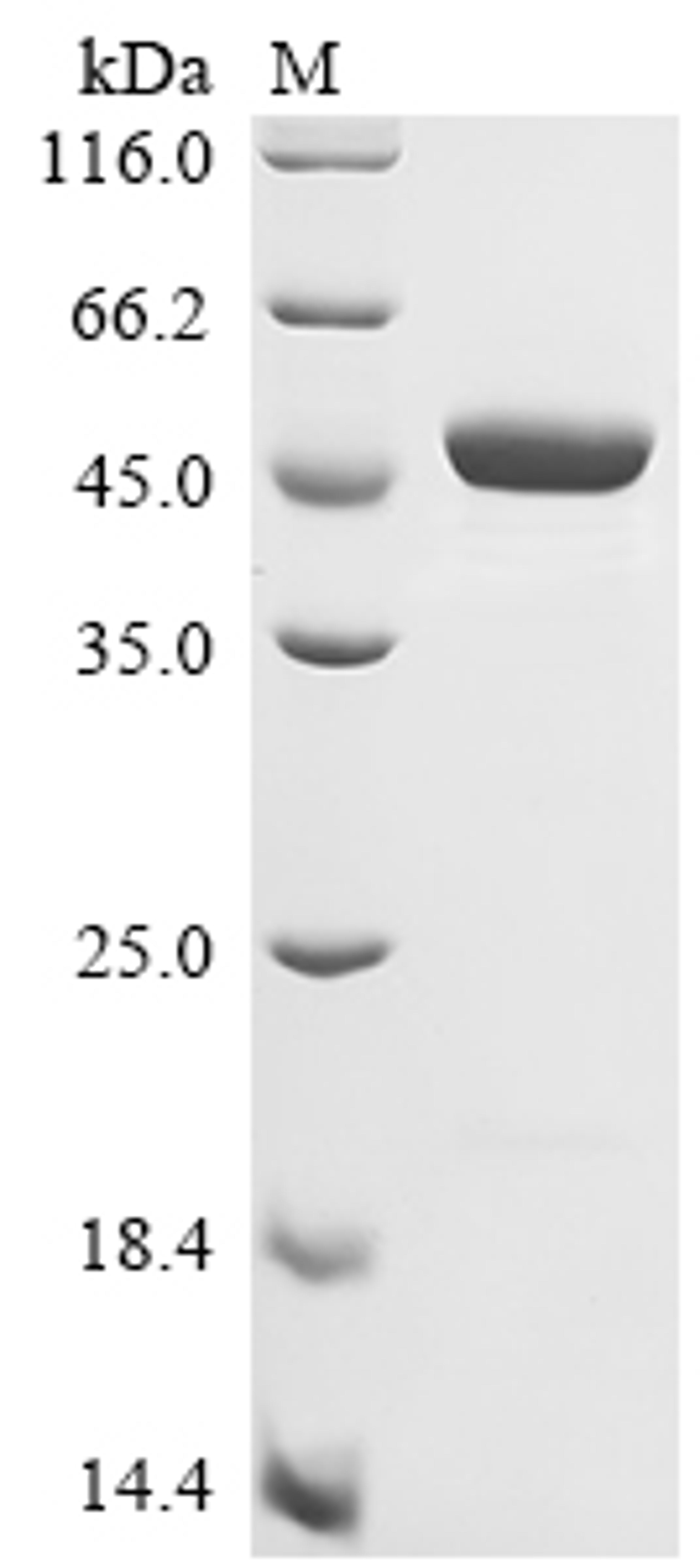 (Tris-Glycine gel) Discontinuous SDS-PAGE (reduced) with 5% enrichment gel and 15% separation gel.