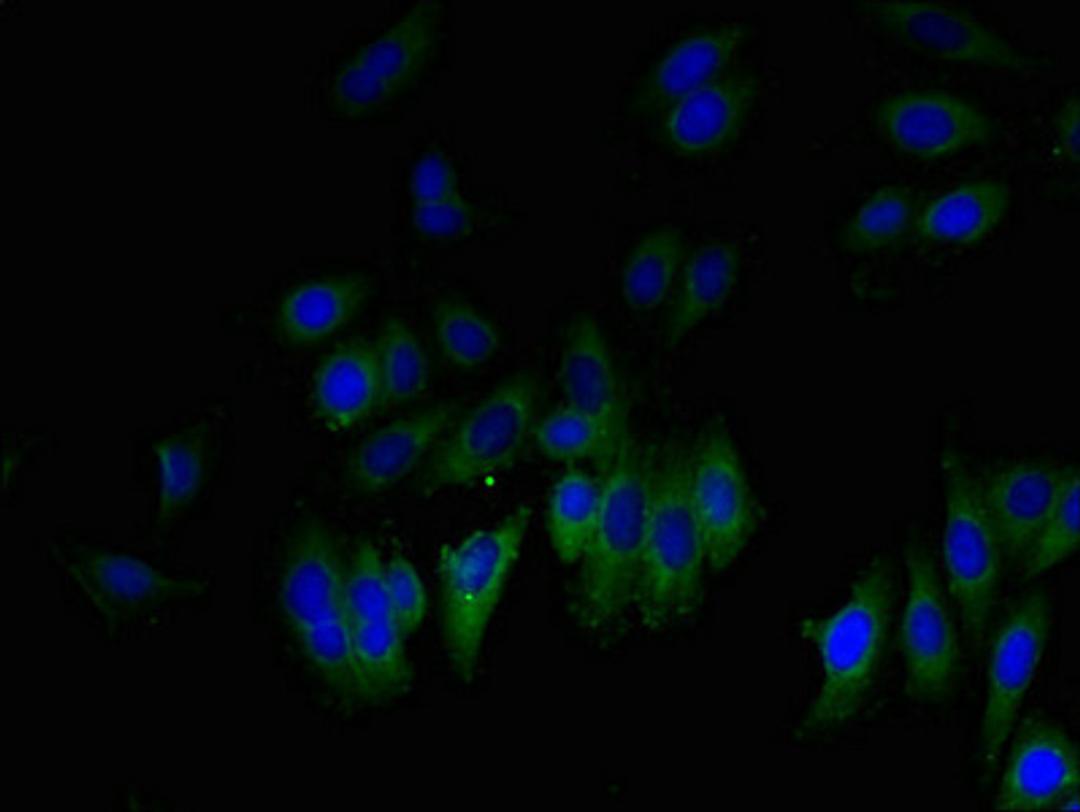 Immunofluorescent analysis of HepG2 cells using CSB-PA009503LA01HU at dilution of 1:100 and Alexa Fluor 488-congugated AffiniPure Goat Anti-Rabbit IgG(H+L)