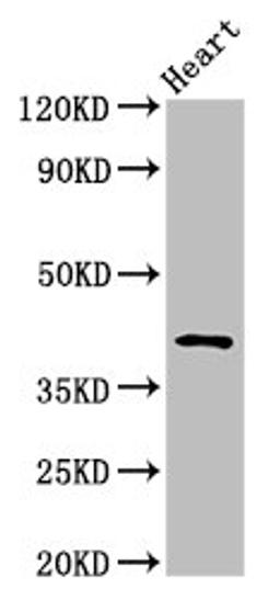 Western Blot. Positive WB detected in: Rat heart tissue. All lanes: JAM3 antibody at 2.5ug/ml. Secondary. Goat polyclonal to rabbit IgG at 1/50000 dilution. Predicted band size: 36, 30 kDa. Observed band size: 45 kDa. 