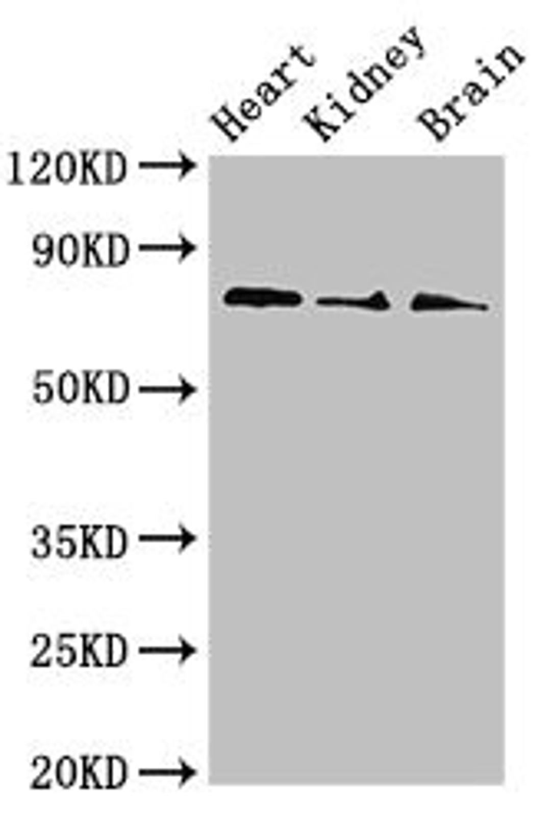 Western Blot. Positive WB detected in: Mouse heart tissue, Mouse kidney tissue, Mouse brain tissue. All lanes: SLC5A1 antibody at 4ug/ml. Secondary. Goat polyclonal to rabbit IgG at 1/50000 dilution. Predicted band size: 74, 61 kDa. Observed band size: 74 kDa. 