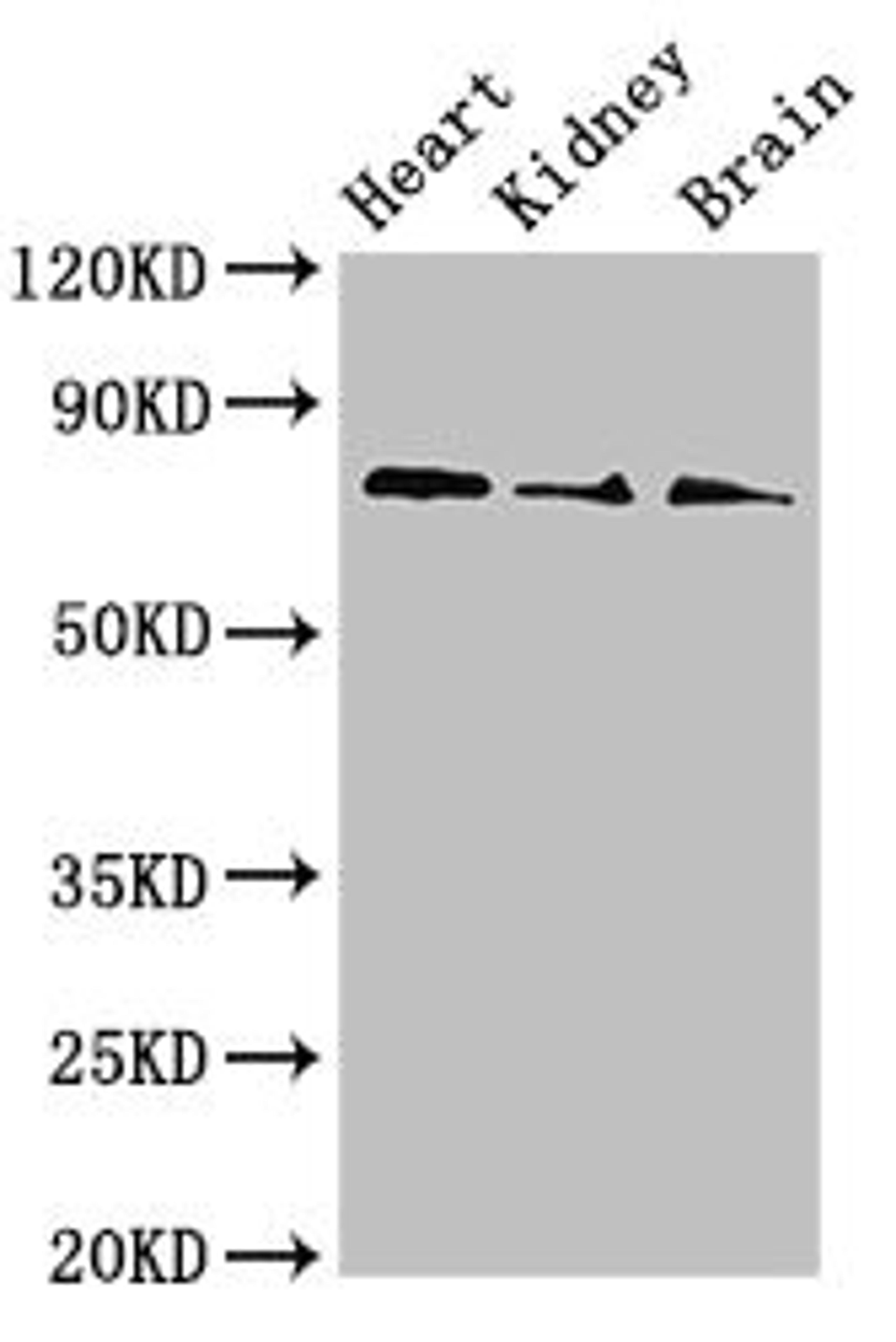 Western Blot. Positive WB detected in: Mouse heart tissue, Mouse kidney tissue, Mouse brain tissue. All lanes: SLC5A1 antibody at 4ug/ml. Secondary. Goat polyclonal to rabbit IgG at 1/50000 dilution. Predicted band size: 74, 61 kDa. Observed band size: 74 kDa. 