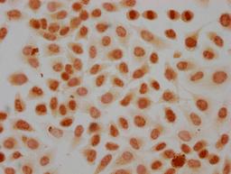 Immunocytochemistry analysis of CSB-PA010418PA41phHU diluted at 1:20 and staining in Hela cells(treated with 50nM Calyculin A for 30min) performed on a Leica BondTM system. The cells were fixed in 4% formaldehyde, permeabilized using 0.2% Triton X-100 and blocked with 10% normal goat serum 30min at RT. Then primary antibody (1% BSA) was incubated at 4°C overnight. The primary is detected by a biotinylated secondary antibody and visualized using an HRP conjugated SP system.