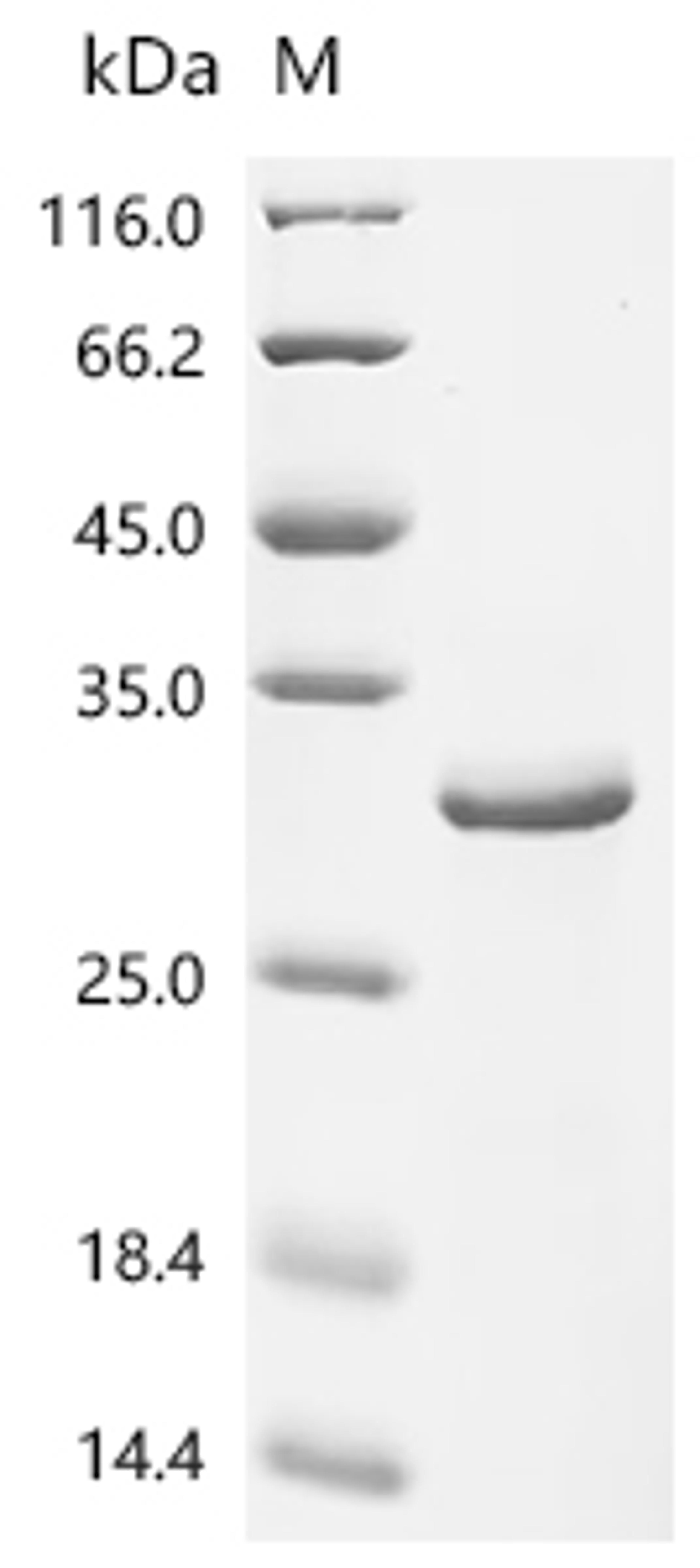 (Tris-Glycine gel) Discontinuous SDS-PAGE (reduced) with 5% enrichment gel and 15% separation gel.