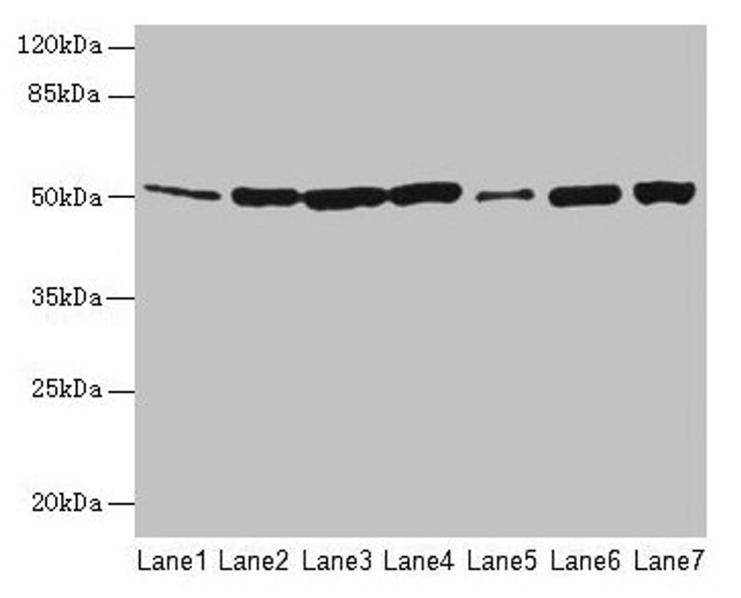 Western blot. All lanes: FH antibody at 12µg/ml. Lane 1: Mouse heart tissue. Lane 2: Mouse liver tissue. Lane 3: Mouse kidney tissue. Lane 4: Mouse brain tissue. Lane 5: Human placenta tissue. Lane 6: Hela whole cell lysate. Lane 7: HepG2 whole cell lysate. Secondary. Goat polyclonal to rabbit IgG at 1/10000 dilution. Predicted band size: 55, 51 kDa. Observed band size: 51 kDa