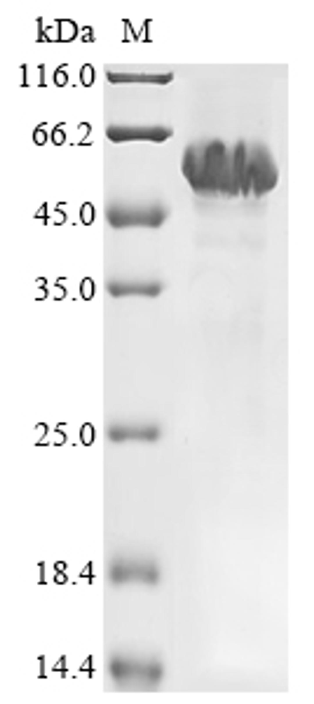 (Tris-Glycine gel) Discontinuous SDS-PAGE (reduced) with 5% enrichment gel and 15% separation gel.