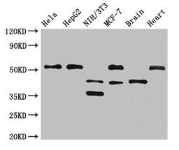 Western Blot. Positive WB detected in: Hela whole cell lysate, HepG2 whole cell lysate, NIH/3T3 whole cell lysate, MCF-7 whole cell lysate, Mouse brain tissue, Rat heart tissue. All lanes: LAX1 antibody at 2.7ug/ml. Secondary. Goat polyclonal to rabbit IgG at 1/50000 dilution. Predicted band size: 45, 36, 43 kDa. Observed band size: 51, 45, 36 kDa. 