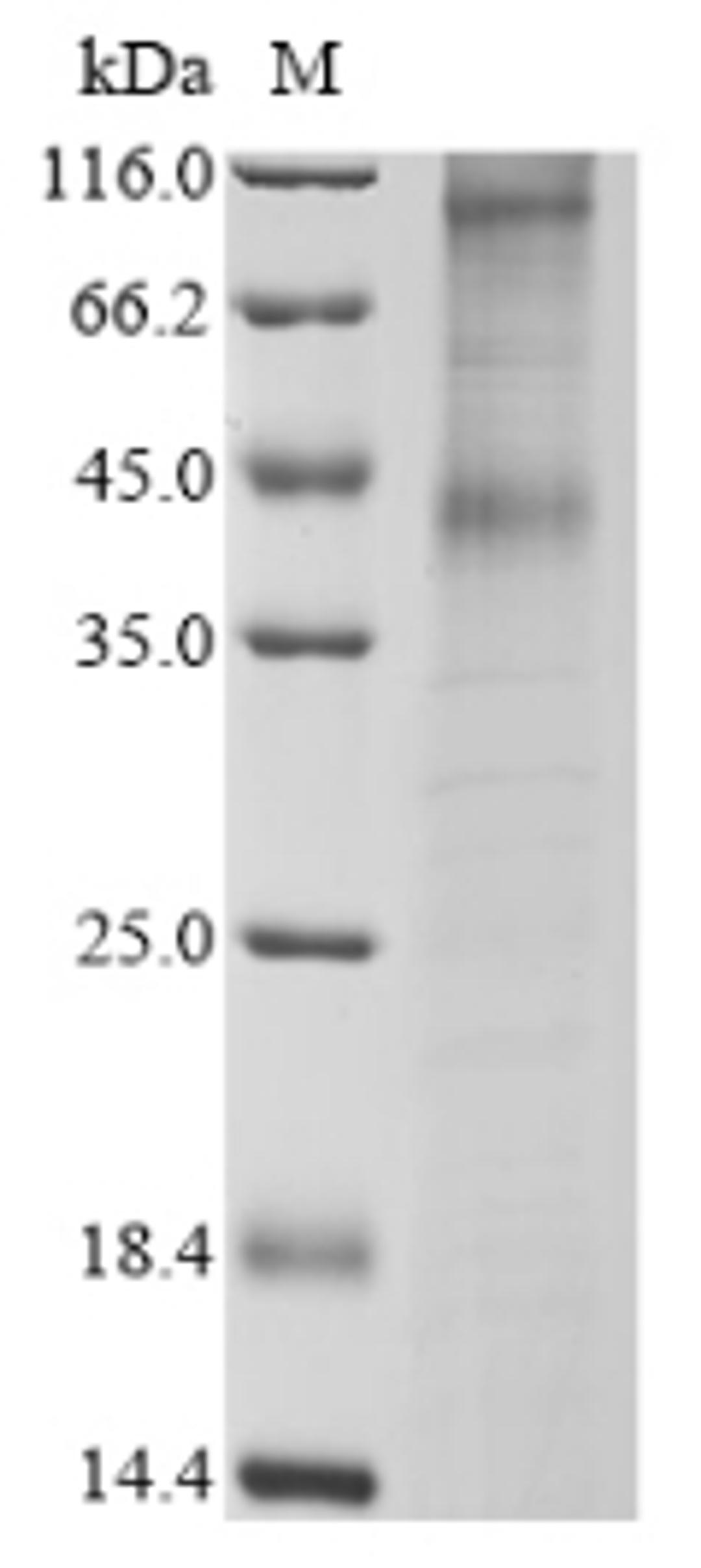 (Tris-Glycine gel) Discontinuous SDS-PAGE (reduced) with 5% enrichment gel and 15% separation gel.