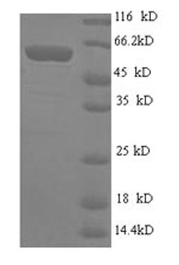 (Tris-Glycine gel) Discontinuous SDS-PAGE (reduced) with 5% enrichment gel and 15% separation gel.