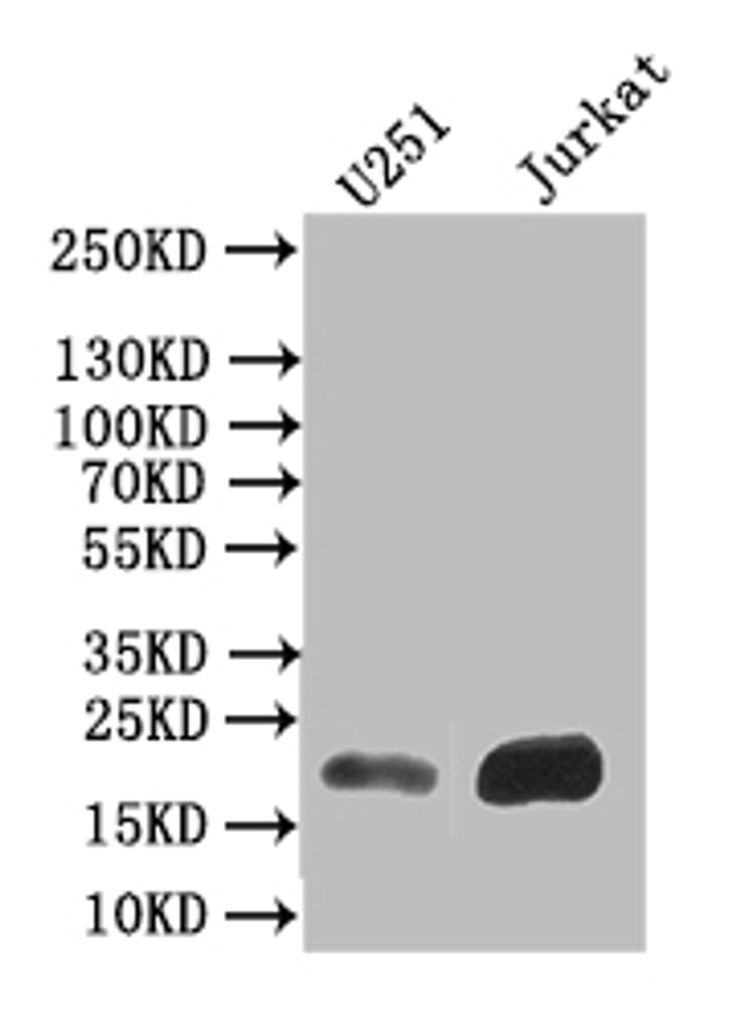 Western Blot. Positive WB detected in: U251 whole cell lysate,JK whole cell lysate. All lanes: FTH1 antibody at 1:500. Secondary. Goat polyclonal to mouse IgG at 1/50000 dilution. Predicted band size: 22 kDa. Observed band size: 22 kDa. 