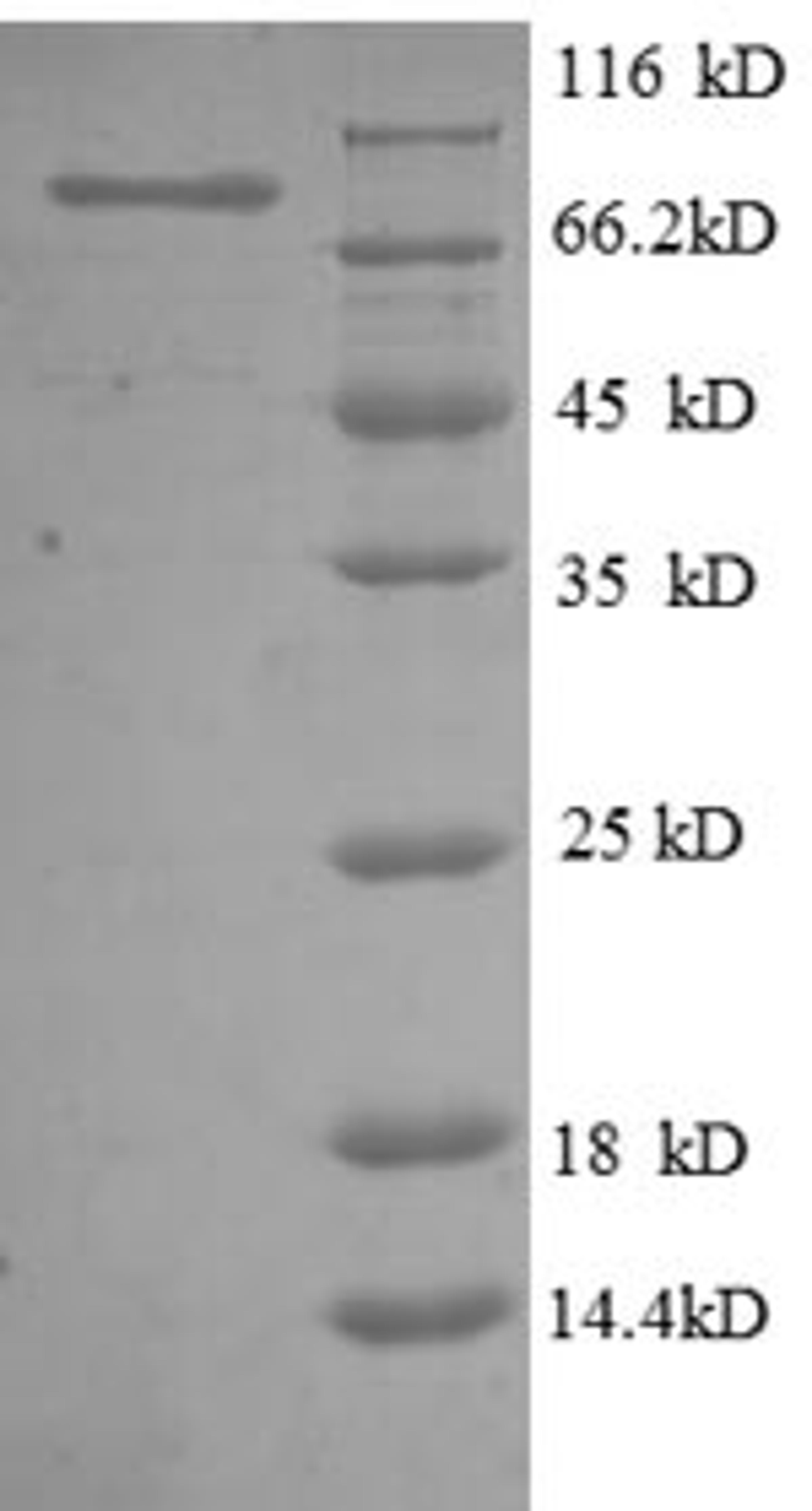 (Tris-Glycine gel) Discontinuous SDS-PAGE (reduced) with 5% enrichment gel and 15% separation gel.