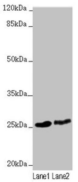 Western blot. All lanes: RNF114 antibody at 1.63µg/ml. Lane 1: 293T whole cell lysate. Lane 2: HepG2 whole cell lysate. Secondary. Goat polyclonal to rabbit IgG at 1/10000 dilution. Predicted band size: 26, 22 kDa. Observed band size: 26 kDa