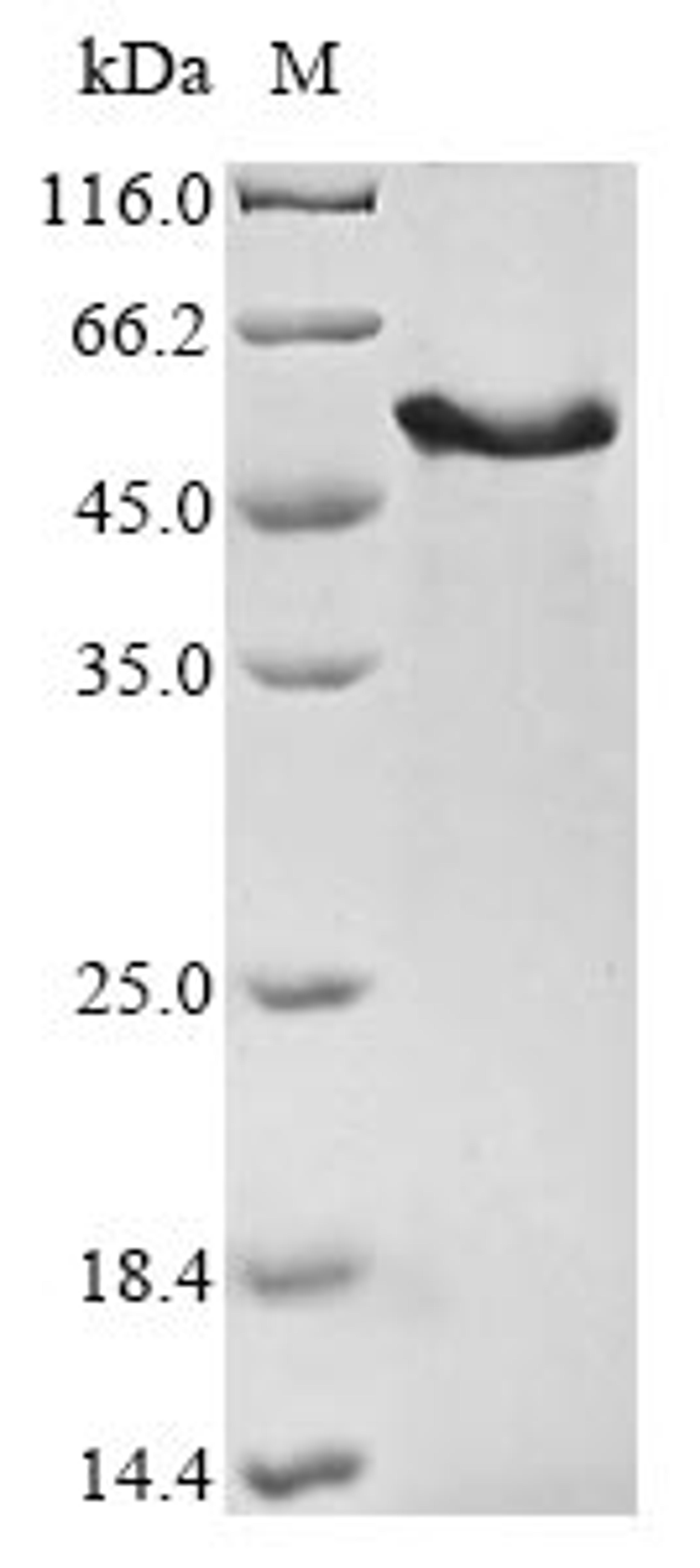 (Tris-Glycine gel) Discontinuous SDS-PAGE (reduced) with 5% enrichment gel and 15% separation gel.
