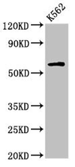 Western Blot. Positive WB detected in: K562 whole cell lysate. All lanes: IL10RA antibody at 2.7µg/ml. Secondary. Goat polyclonal to rabbit IgG at 1/50000 dilution. Predicted band size: 64 kDa. Observed band size: 64 kDa
