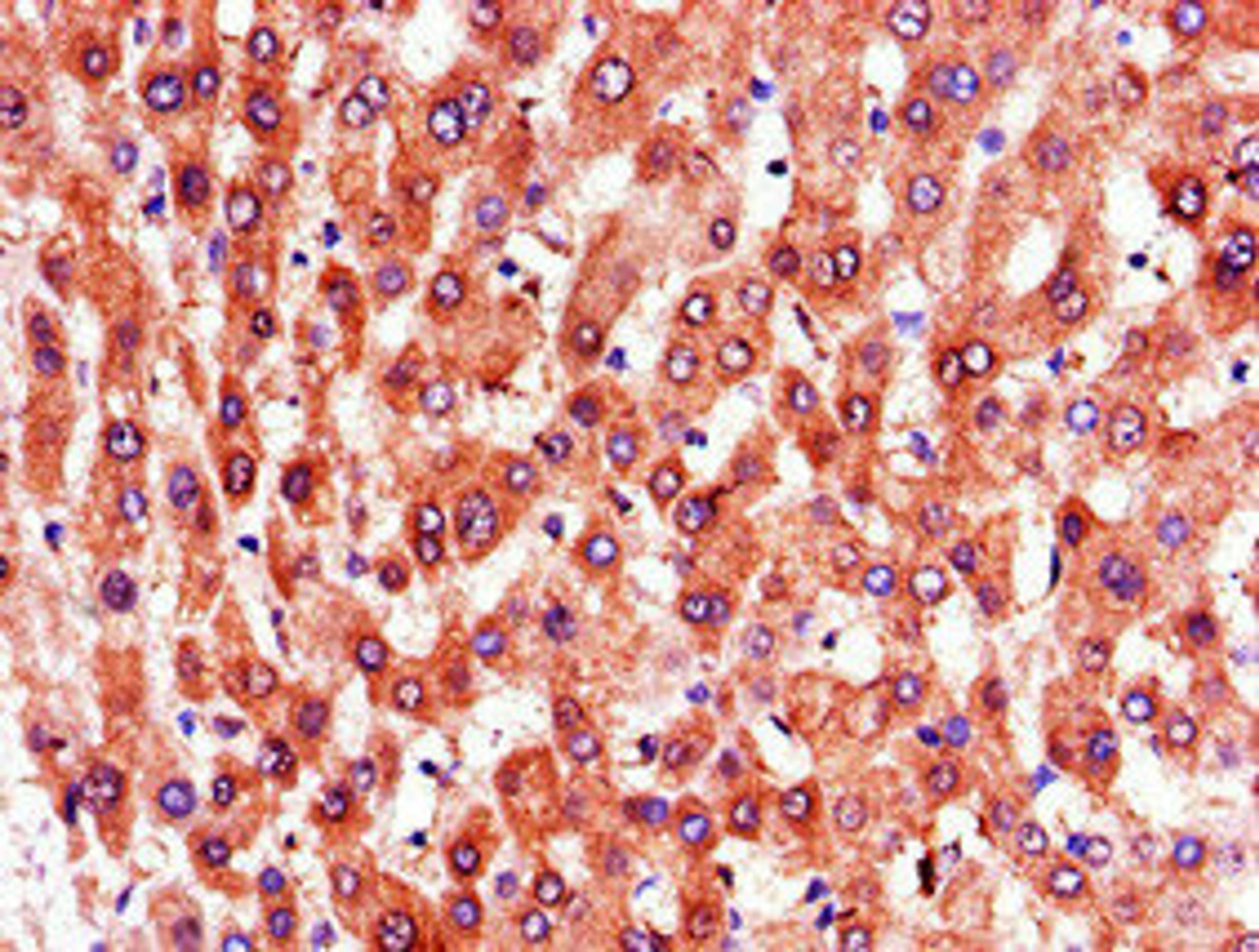 Immunohistochemistry of paraffin-embedded human liver tissue using CSB-PA018983LA01HU at dilution of 1:100