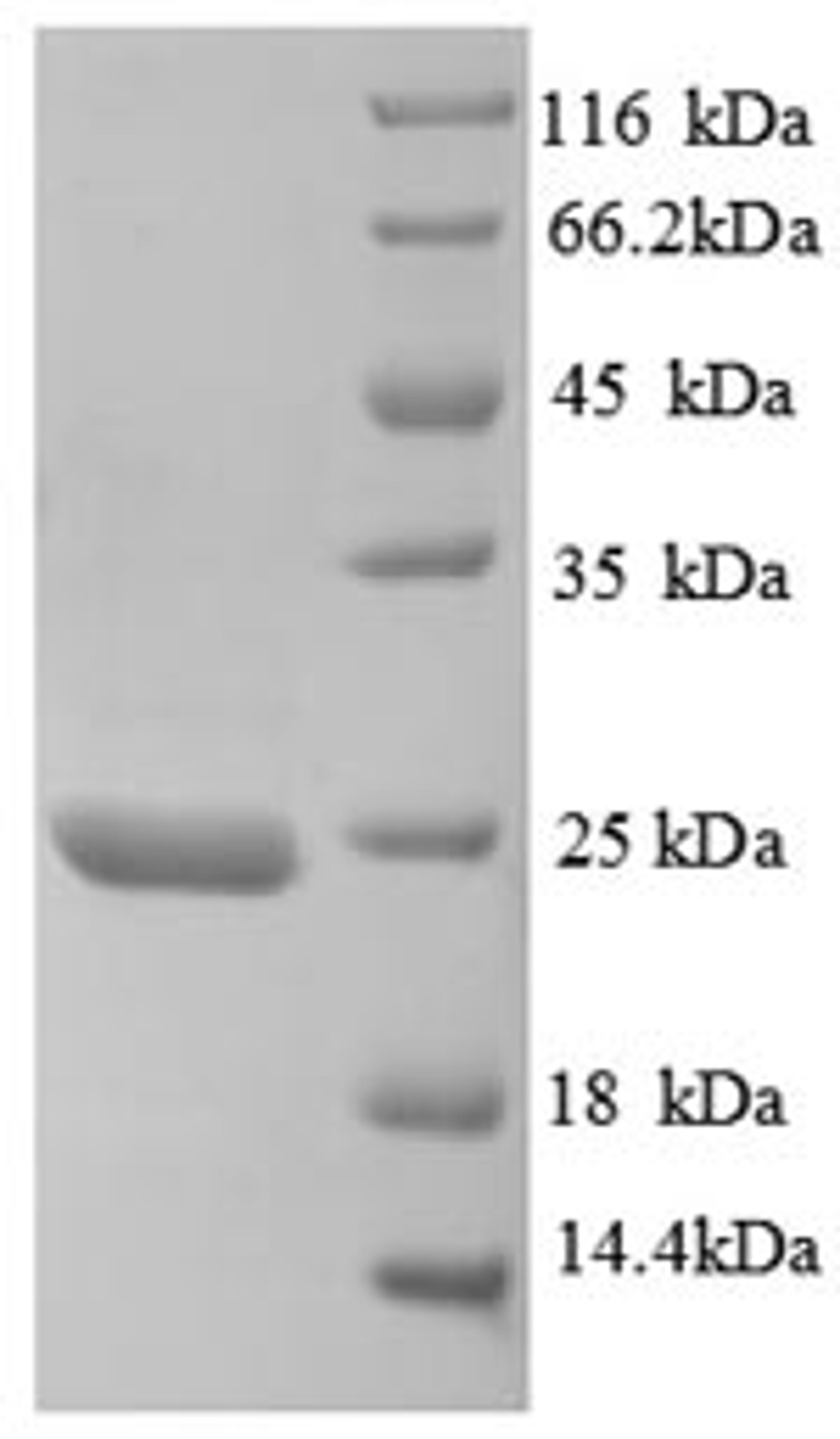 (Tris-Glycine gel) Discontinuous SDS-PAGE (reduced) with 5% enrichment gel and 15% separation gel.