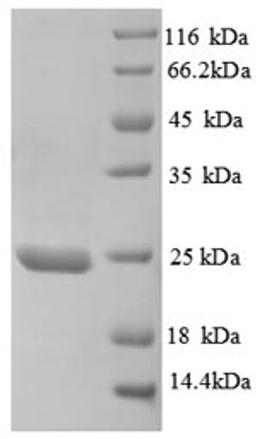 (Tris-Glycine gel) Discontinuous SDS-PAGE (reduced) with 5% enrichment gel and 15% separation gel.