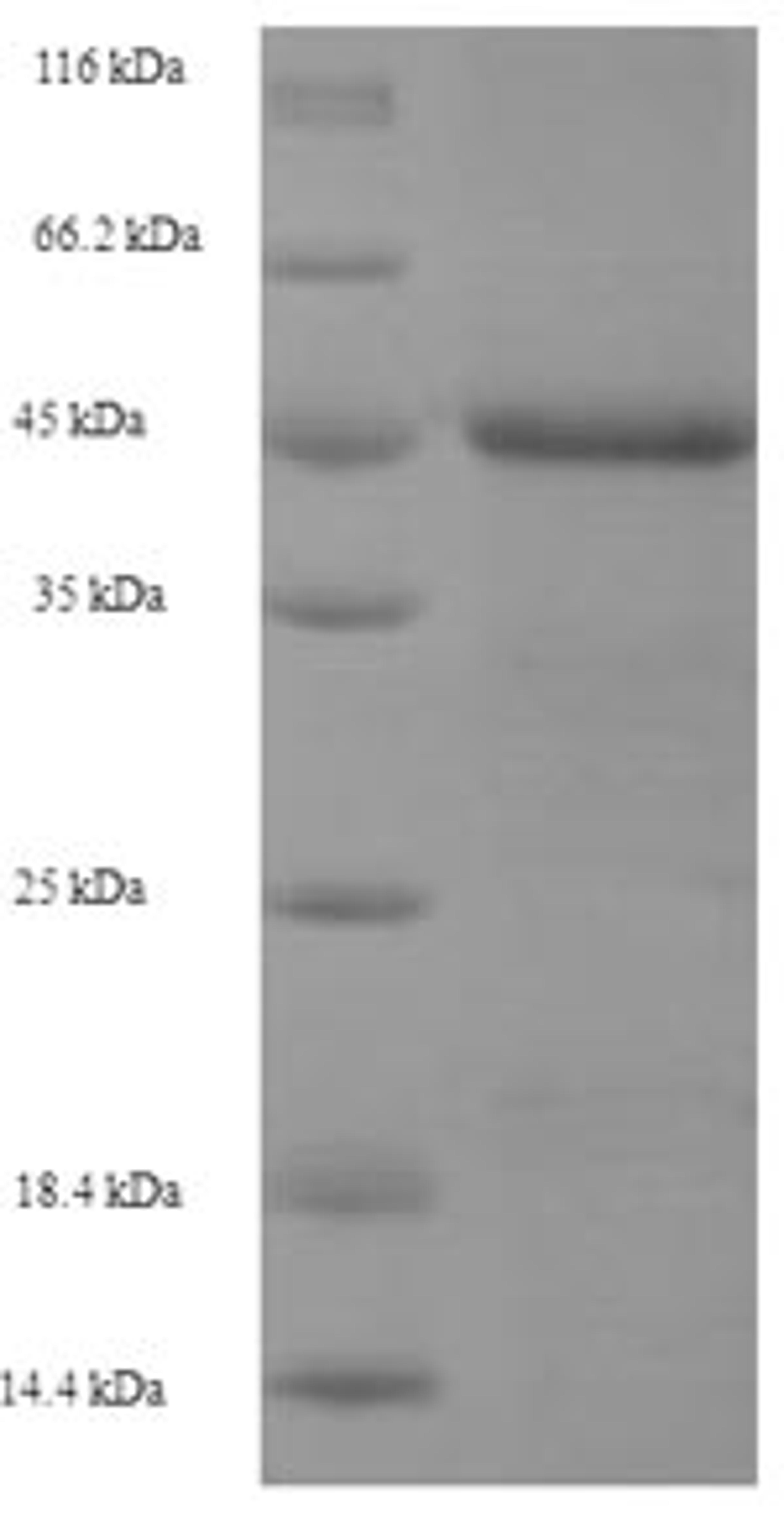 (Tris-Glycine gel) Discontinuous SDS-PAGE (reduced) with 5% enrichment gel and 15% separation gel.