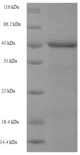 (Tris-Glycine gel) Discontinuous SDS-PAGE (reduced) with 5% enrichment gel and 15% separation gel.