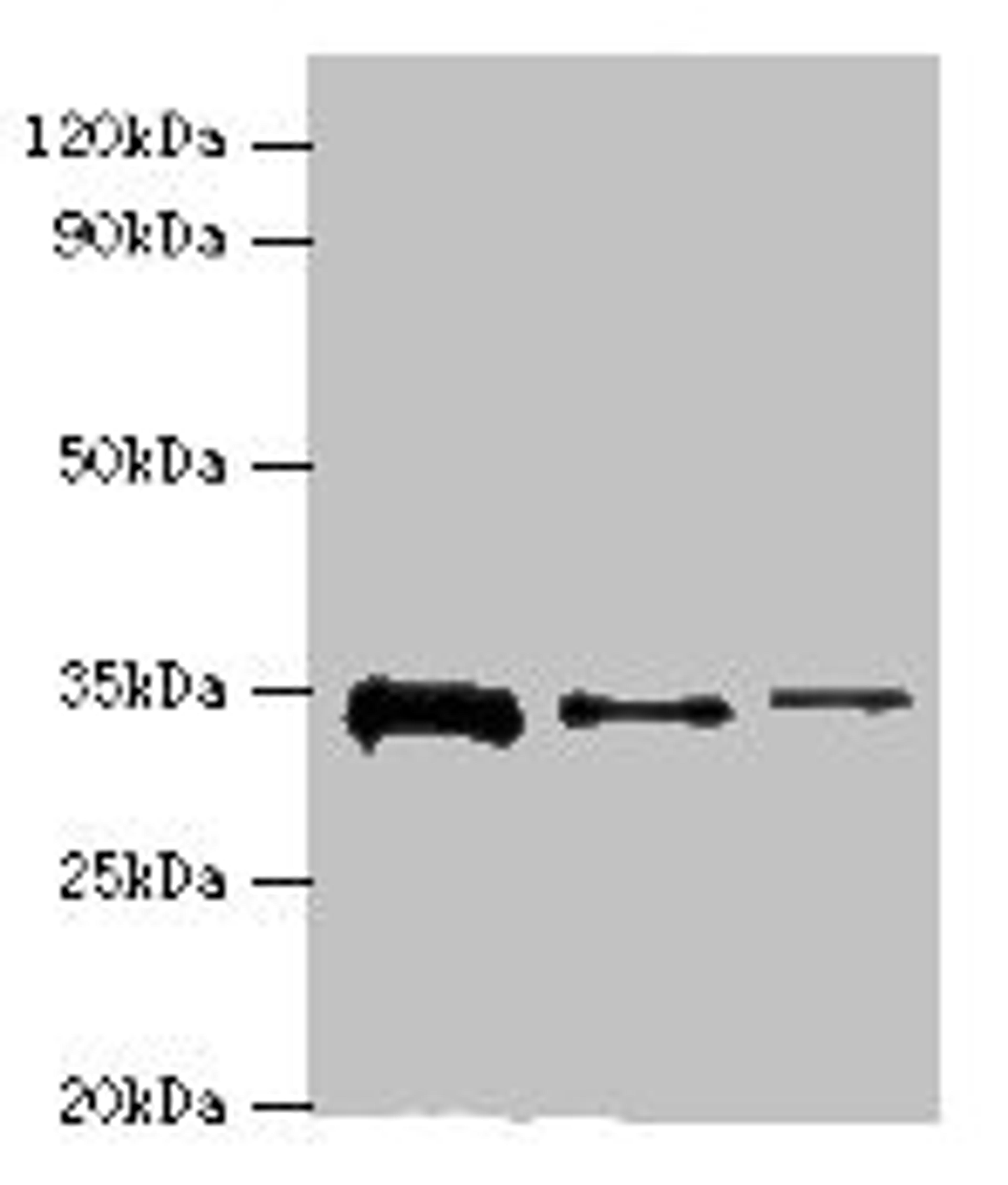 Western blot. All lanes: STK16 antibody at 12ug/ml. Lane 1: A549 whole cell lysate. Lane 2: Mouse brain tissue. Lane 3: A431 whole cell lysate. Secondary. Goat polyclonal to rabbit IgG at 1/10000 dilution. Predicted band size: 35 kDa. Observed band size: 35 kDa. 