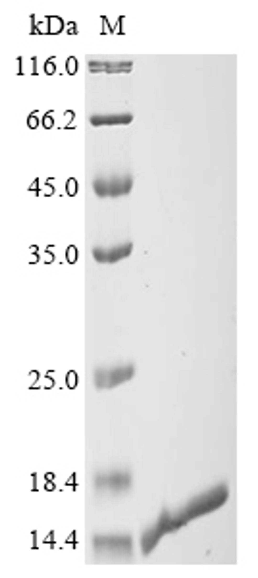 (Tris-Glycine gel) Discontinuous SDS-PAGE (reduced) with 5% enrichment gel and 15% separation gel.