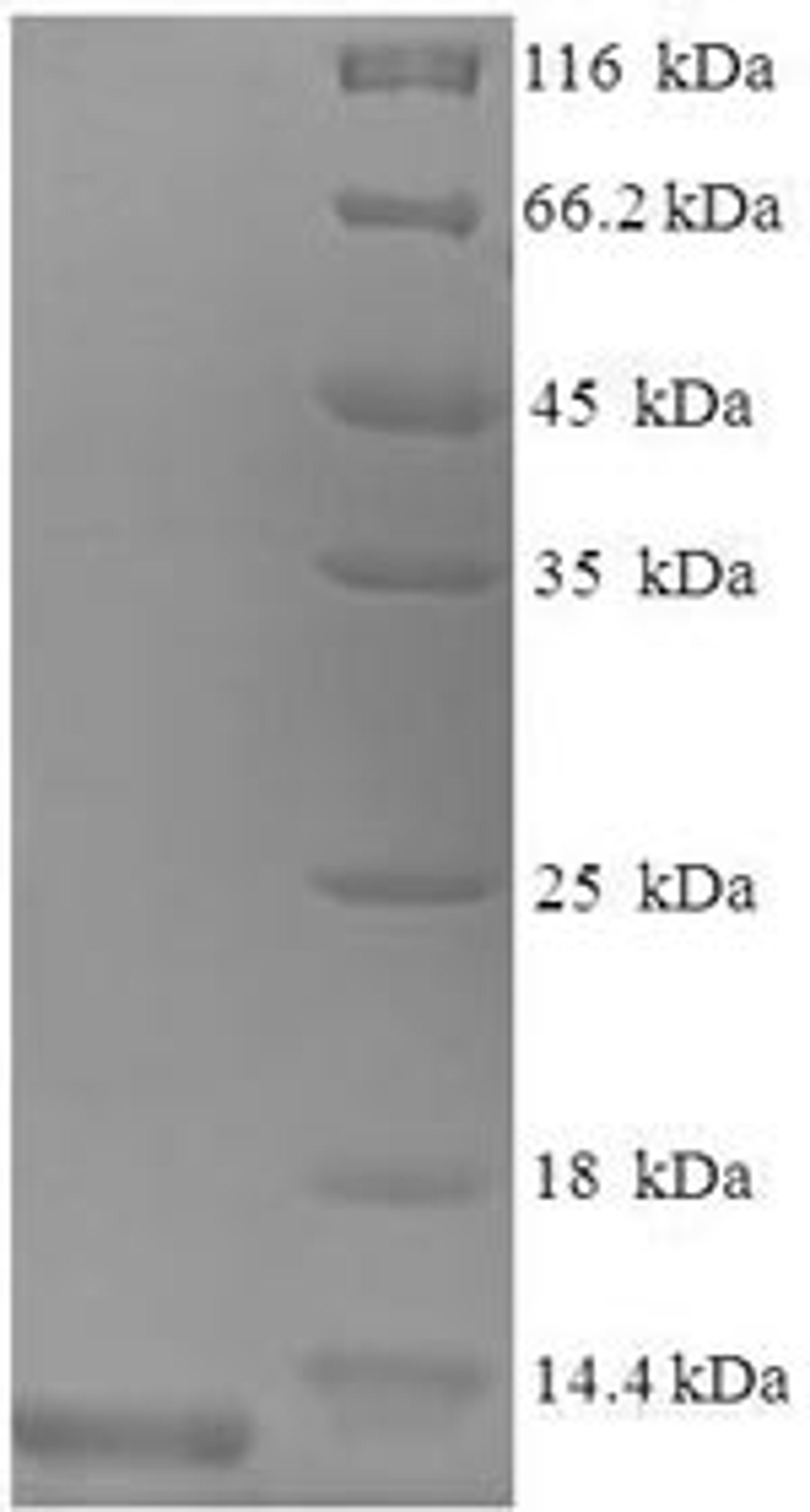 (Tris-Glycine gel) Discontinuous SDS-PAGE (reduced) with 5% enrichment gel and 15% separation gel.