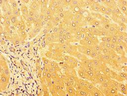 Immunohistochemistry of paraffin-embedded human liver tissue using CSB-PA757664LA01HU at dilution of 1:100