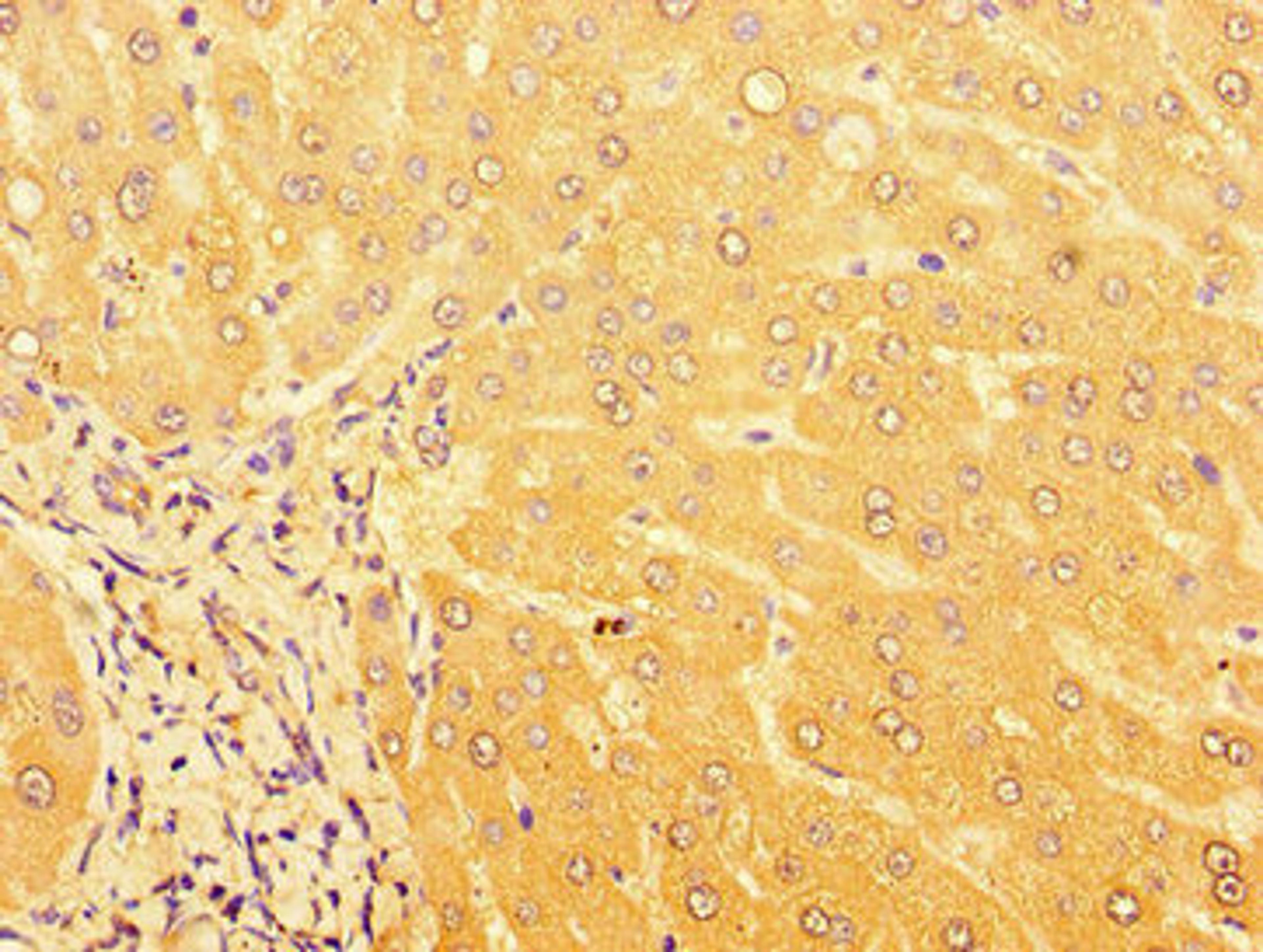 Immunohistochemistry of paraffin-embedded human liver tissue using CSB-PA757664LA01HU at dilution of 1:100
