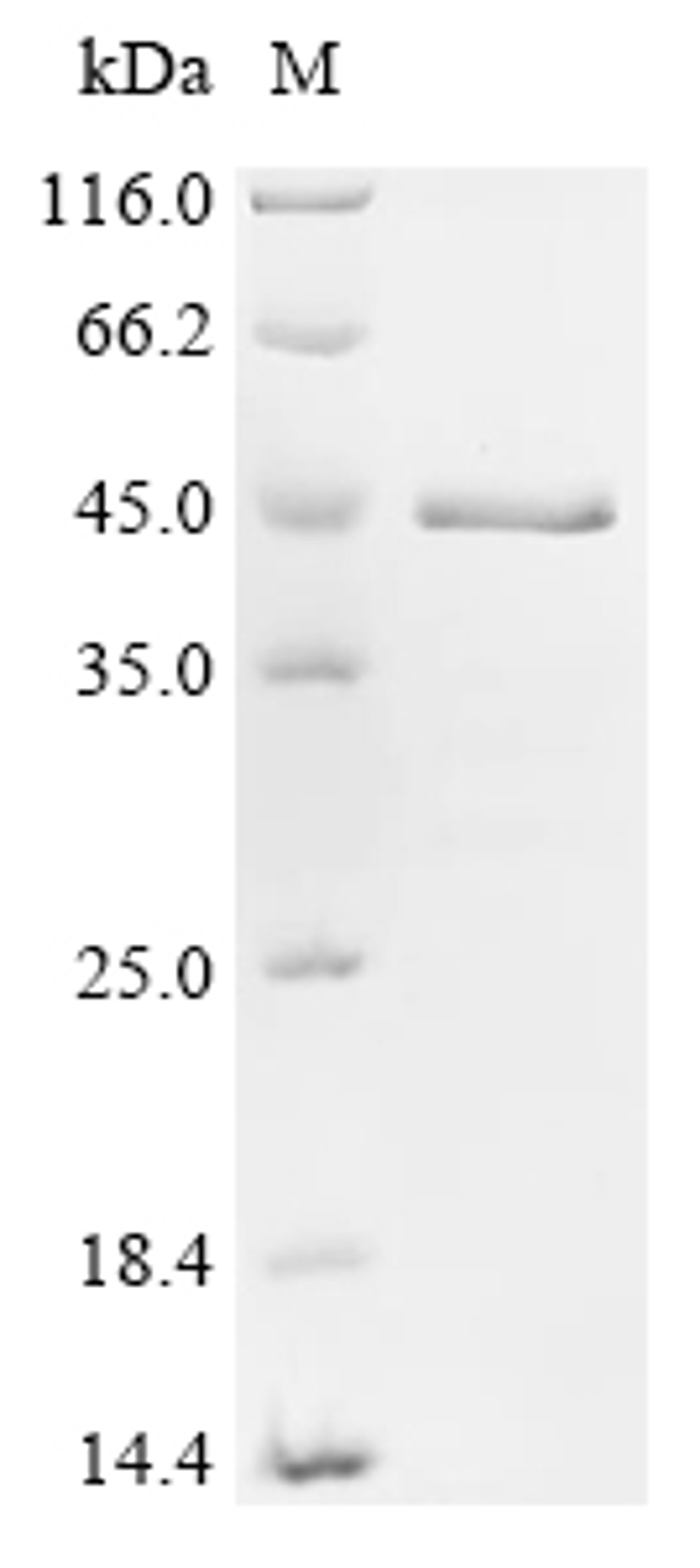 (Tris-Glycine gel) Discontinuous SDS-PAGE (reduced) with 5% enrichment gel and 15% separation gel.