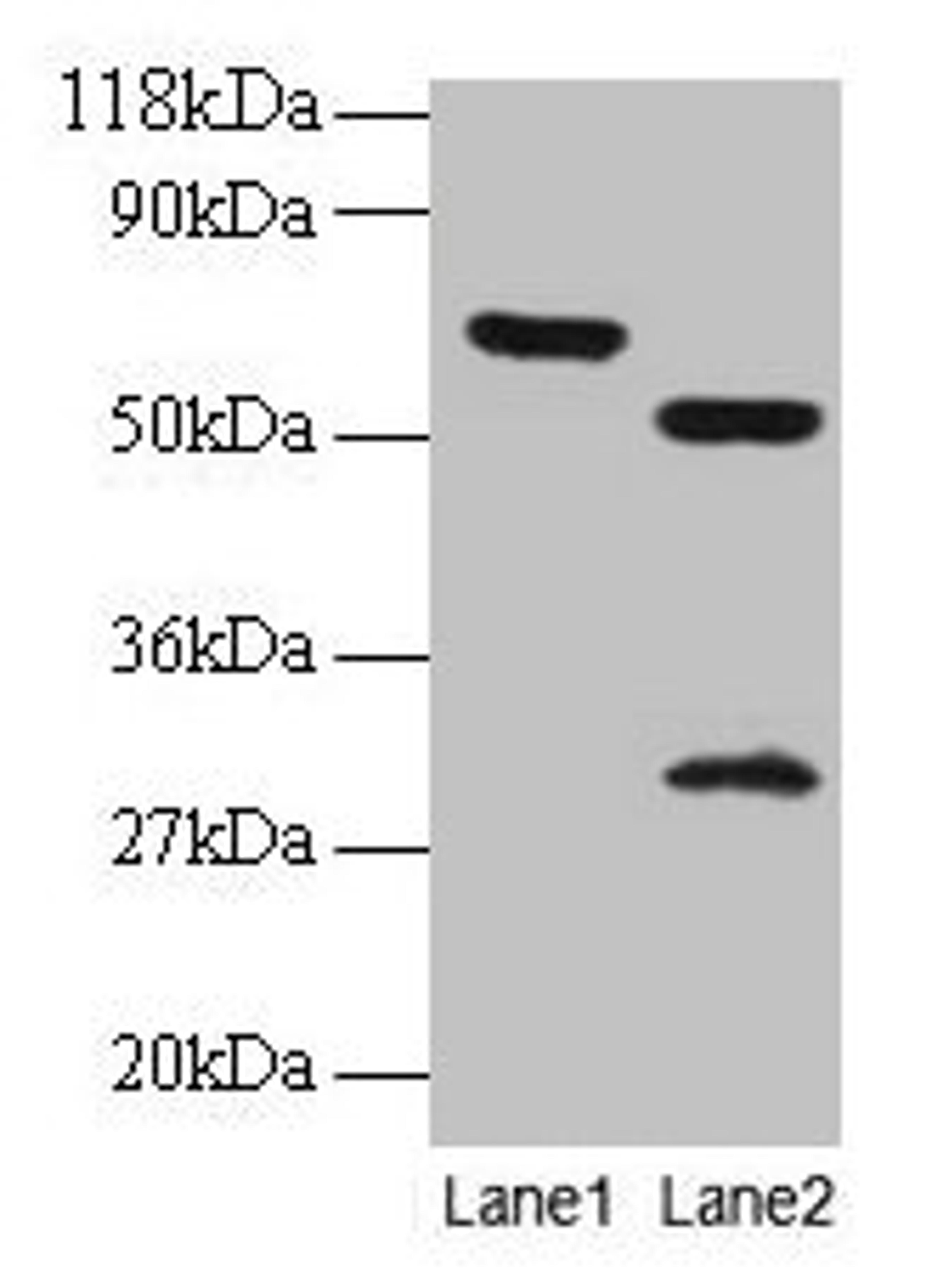 Western blot. All lanes: ZNF384 antibody at 2µg/ml. Lane 1: EC109 whole cell lysate. Lane 2: 293T whole cell lysate. Secondary. Goat polyclonal to rabbit IgG at 1/15000 dilution. Predicted band size: 64, 57, 51 kDa. Observed band size: 64, 51, 30 kDa