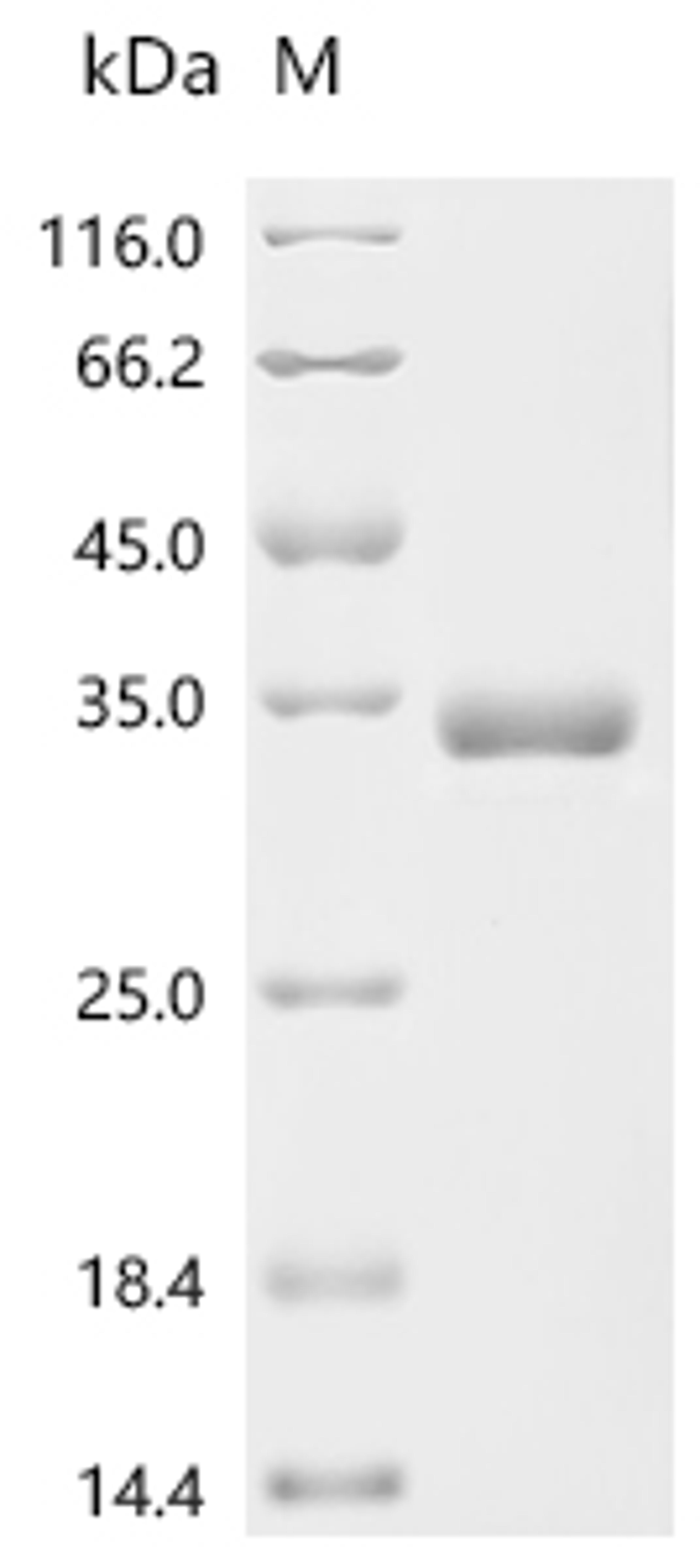(Tris-Glycine gel) Discontinuous SDS-PAGE (reduced) with 5% enrichment gel and 15% separation gel.