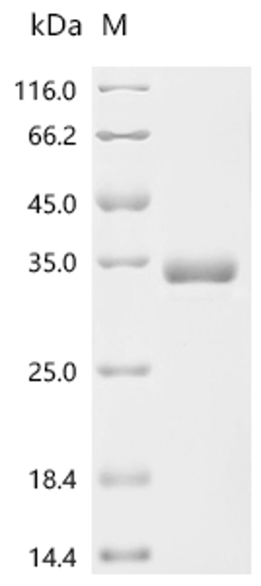 (Tris-Glycine gel) Discontinuous SDS-PAGE (reduced) with 5% enrichment gel and 15% separation gel.