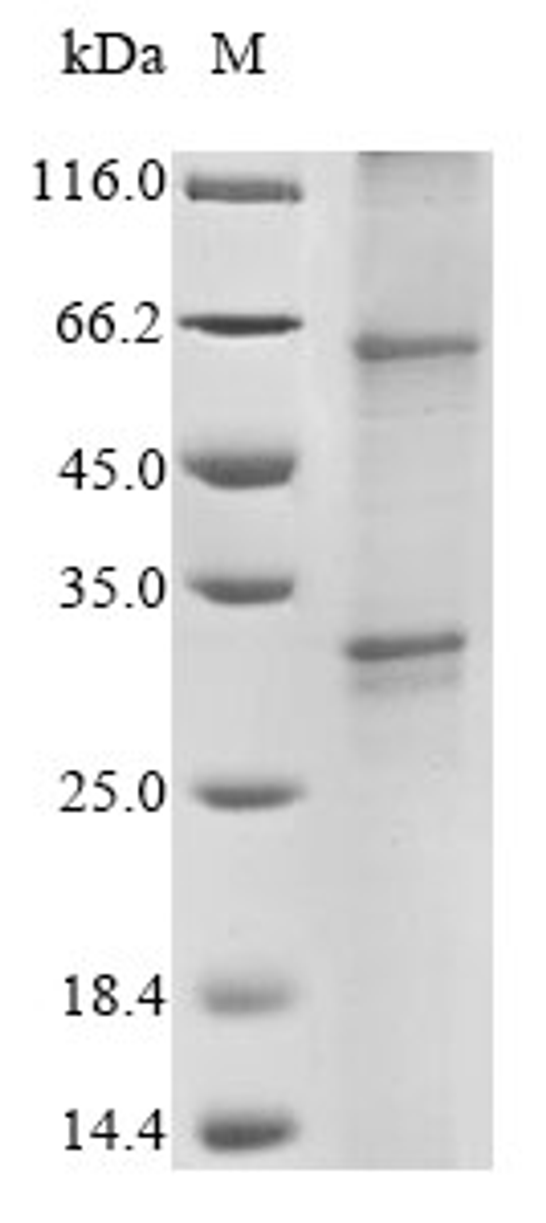 (Tris-Glycine gel) Discontinuous SDS-PAGE (reduced) with 5% enrichment gel and 15% separation gel.