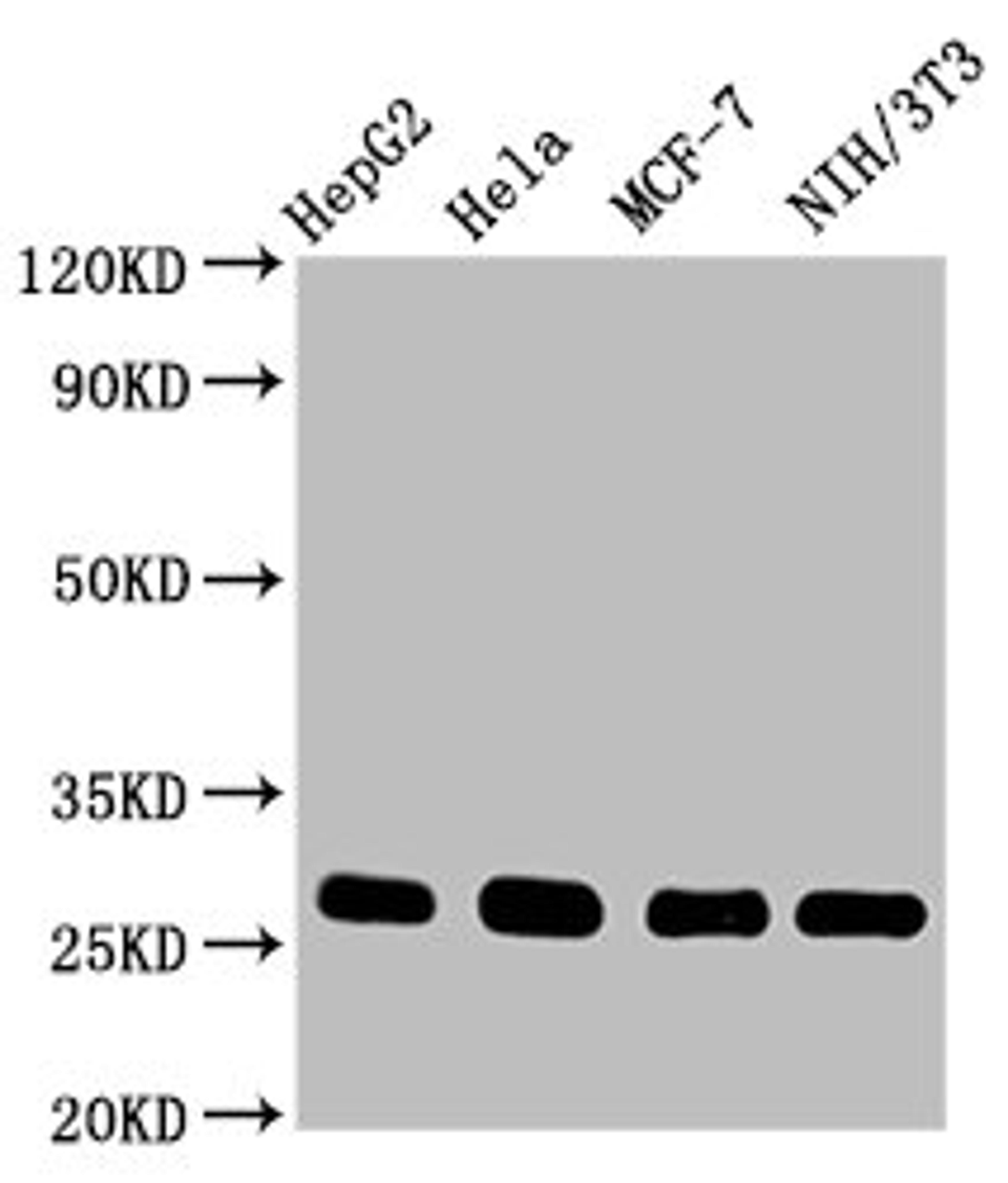 Western Blot. Positive WB detected in: HepG2 whole cell lysate, Hela whole cell lysate, MCF-7 whole cell lysate, NIH/3T3 whole cell lysate. All lanes: CDKN1B antibody at 0.9μg/ml. Secondary. Goat polyclonal to rabbit IgG at 1/50000 dilution. Predicted band size: 23 KDa. Observed band size: 27 KDa.