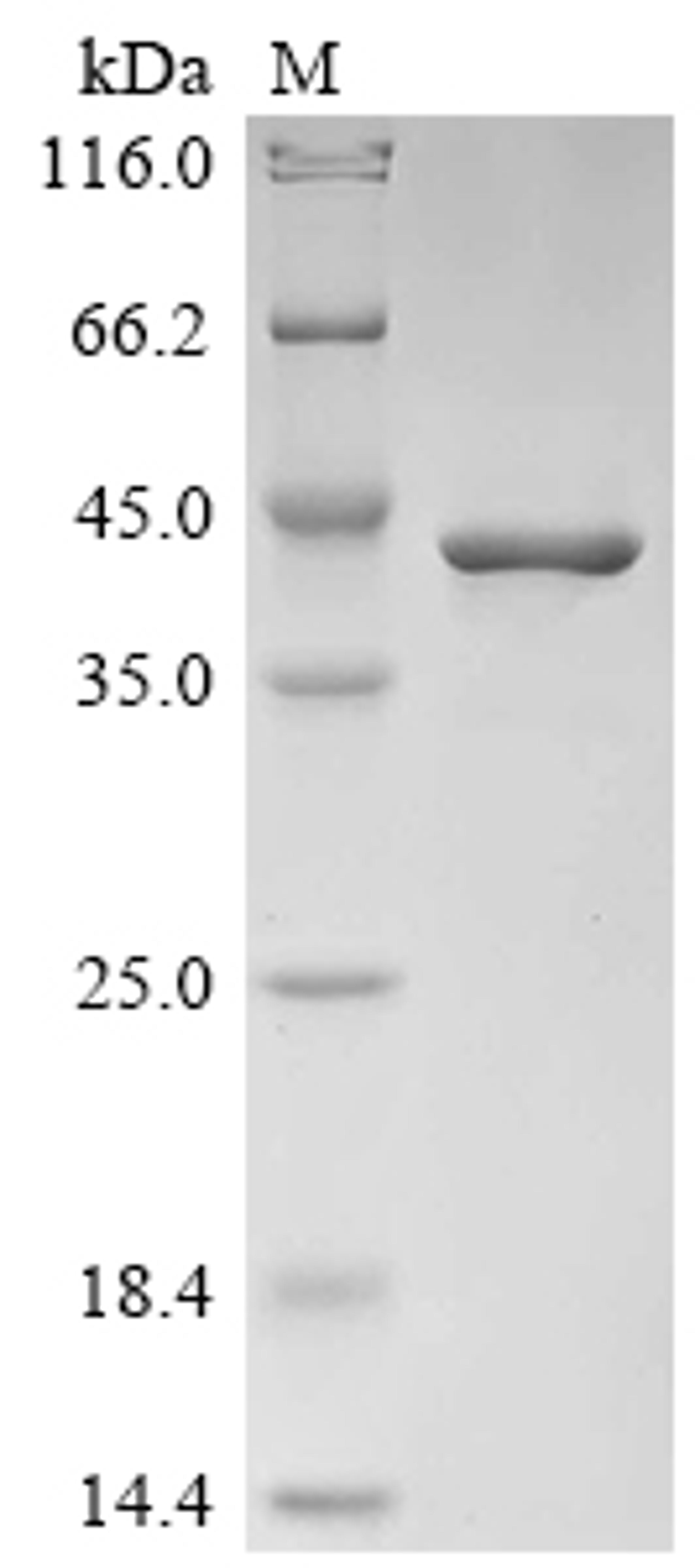 (Tris-Glycine gel) Discontinuous SDS-PAGE (reduced) with 5% enrichment gel and 15% separation gel.