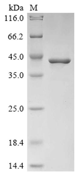 (Tris-Glycine gel) Discontinuous SDS-PAGE (reduced) with 5% enrichment gel and 15% separation gel.