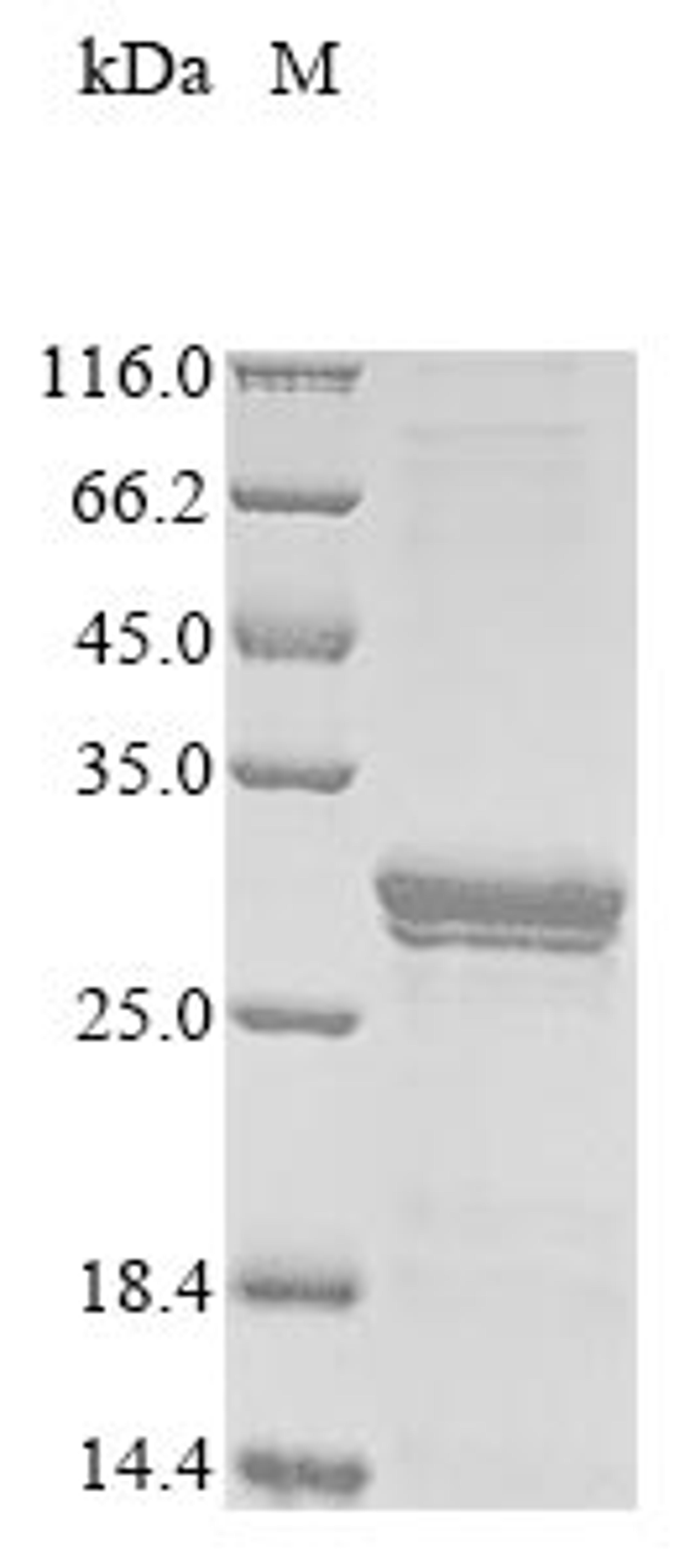 (Tris-Glycine gel) Discontinuous SDS-PAGE (reduced) with 5% enrichment gel and 15% separation gel.