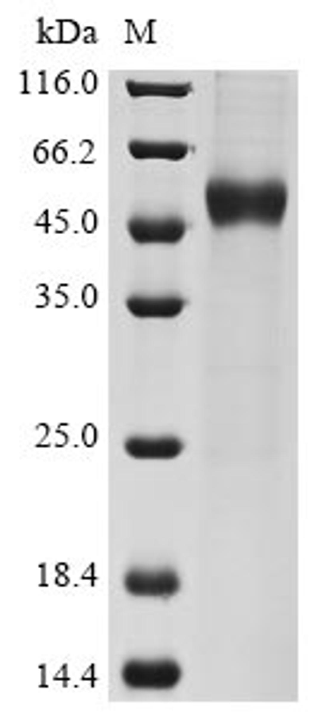 (Tris-Glycine gel) Discontinuous SDS-PAGE (reduced) with 5% enrichment gel and 15% separation gel.