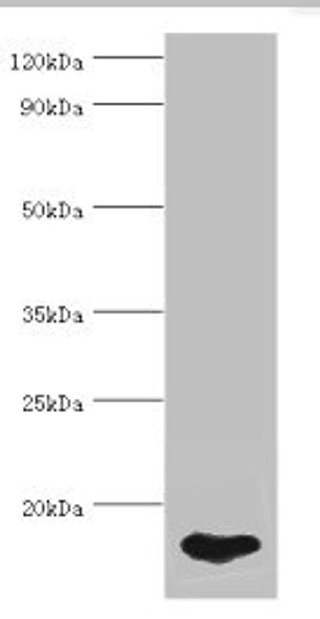 Western blot. All lanes: FABP5 antibody at 5ug/ml + HepG2 whole cell lysate. Secondary. Goat polyclonal to rabbit IgG at 1/10000 dilution. Predicted band size: 15 kDa. Observed band size: 15 kDa. 