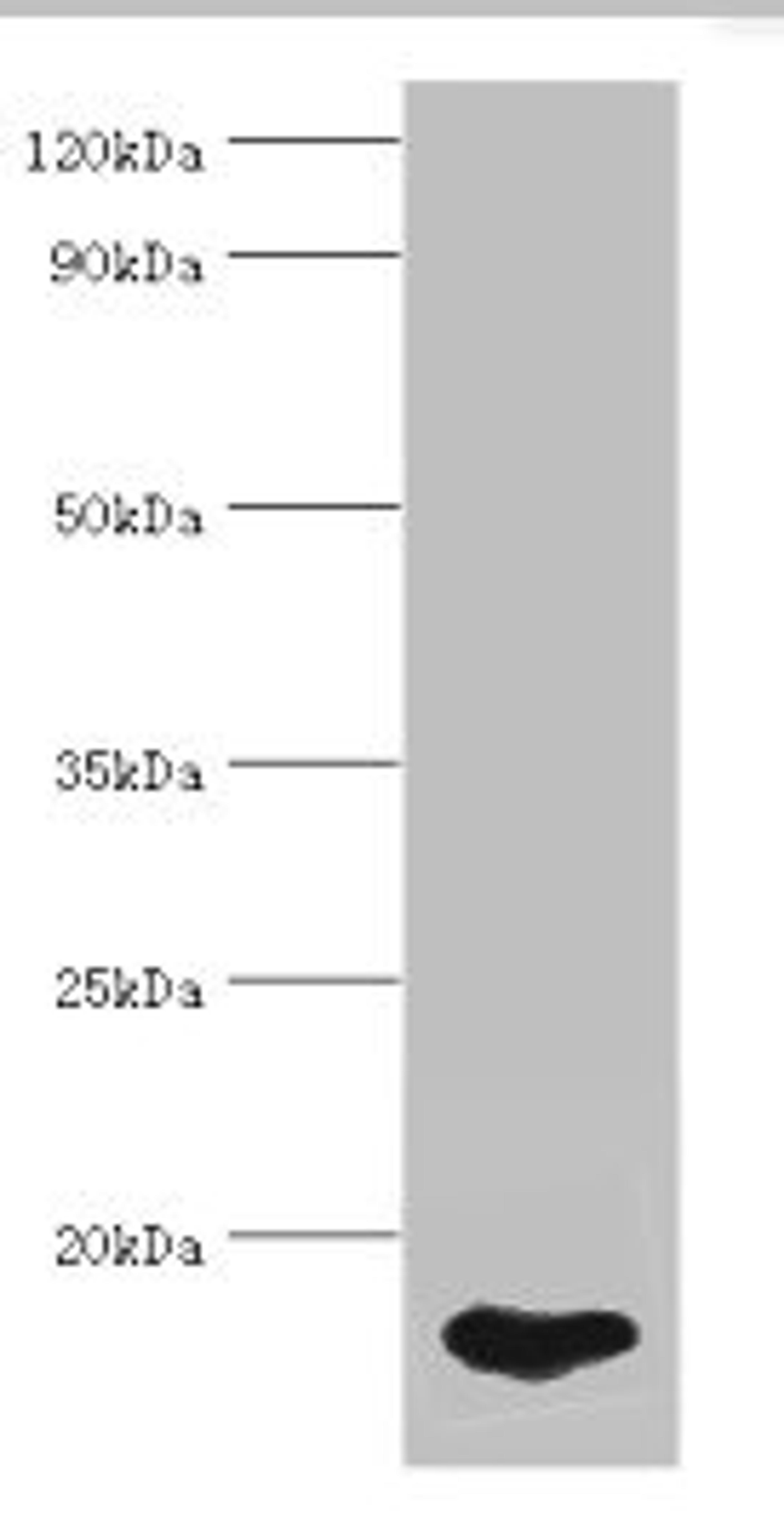 Western blot. All lanes: FABP5 antibody at 5ug/ml + HepG2 whole cell lysate. Secondary. Goat polyclonal to rabbit IgG at 1/10000 dilution. Predicted band size: 15 kDa. Observed band size: 15 kDa. 