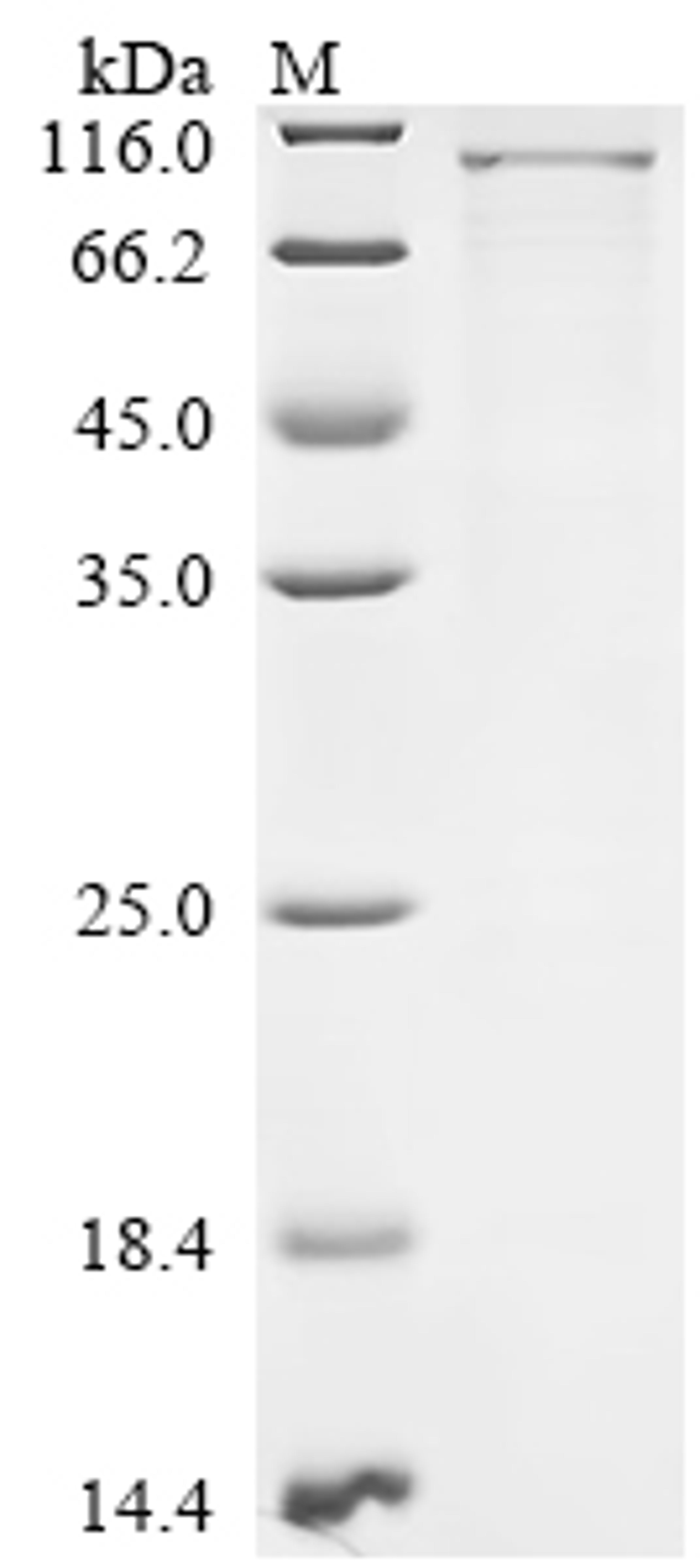 (Tris-Glycine gel) Discontinuous SDS-PAGE (reduced) with 5% enrichment gel and 15% separation gel.