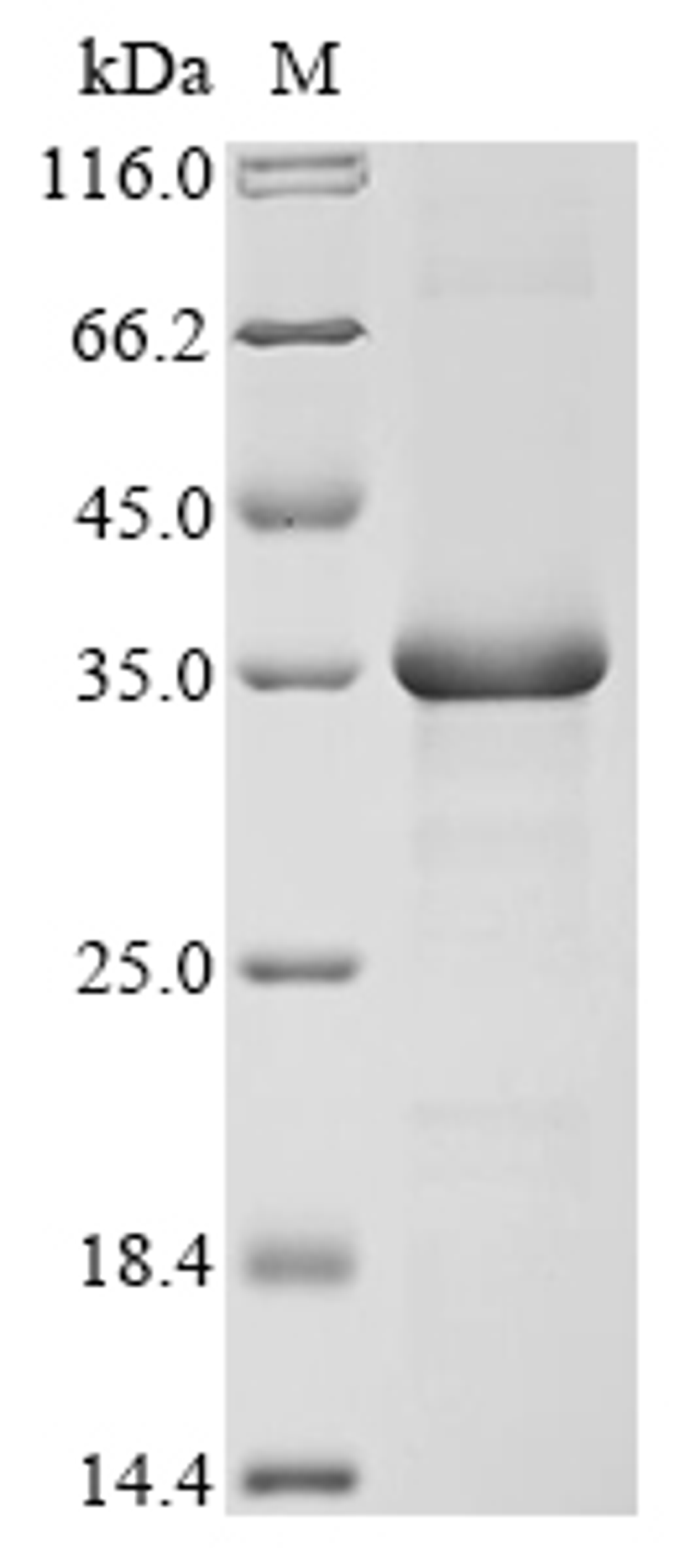 (Tris-Glycine gel) Discontinuous SDS-PAGE (reduced) with 5% enrichment gel and 15% separation gel.