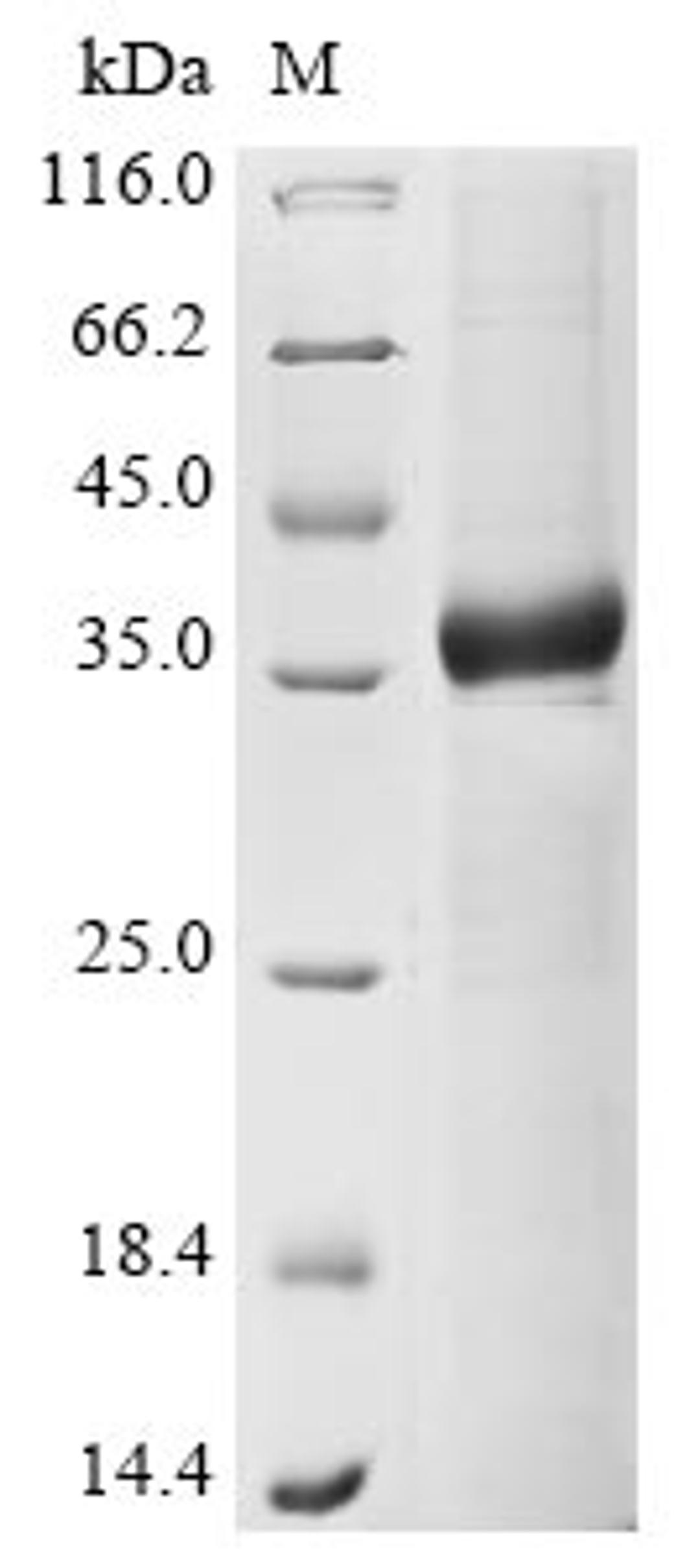 (Tris-Glycine gel) Discontinuous SDS-PAGE (reduced) with 5% enrichment gel and 15% separation gel.