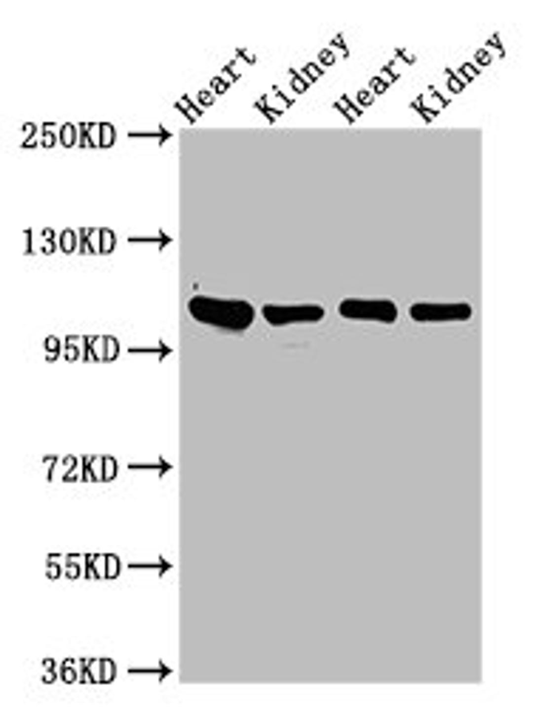 Western Blot. Positive WB detected in: Rat heart tissue, Rat kidney tissue, Mouse heart tisseu, Mouse kidney tissue. All lanes: ITGA6 antibody at 3ug/ml. Secondary. Goat polyclonal to rabbit IgG at 1/50000 dilution. Predicted band size: 127, 120, 123, 122, 125, 107 kDa. Observed band size: 100 kDa. 