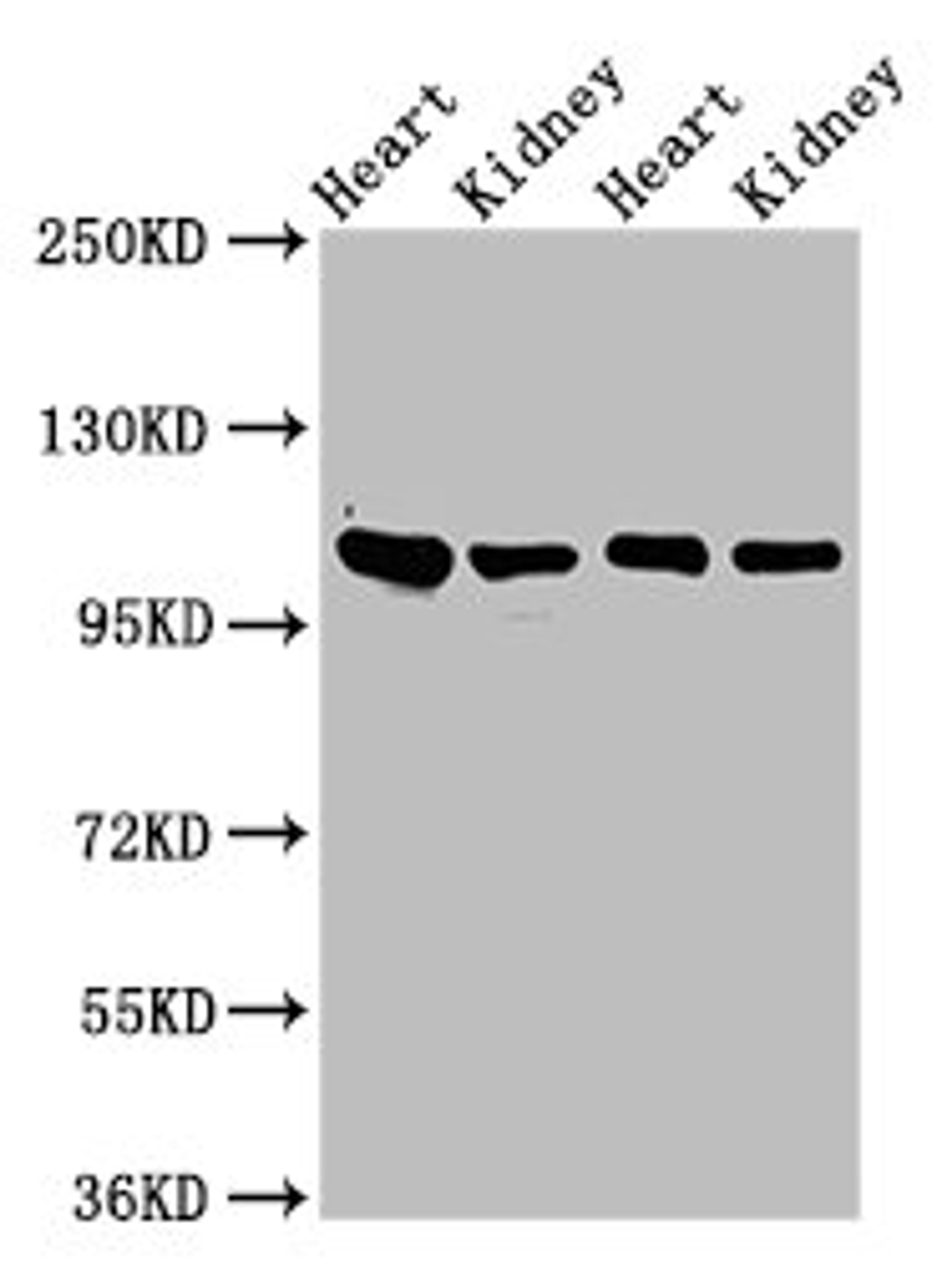 Western Blot. Positive WB detected in: Rat heart tissue, Rat kidney tissue, Mouse heart tisseu, Mouse kidney tissue. All lanes: ITGA6 antibody at 3ug/ml. Secondary. Goat polyclonal to rabbit IgG at 1/50000 dilution. Predicted band size: 127, 120, 123, 122, 125, 107 kDa. Observed band size: 100 kDa. 