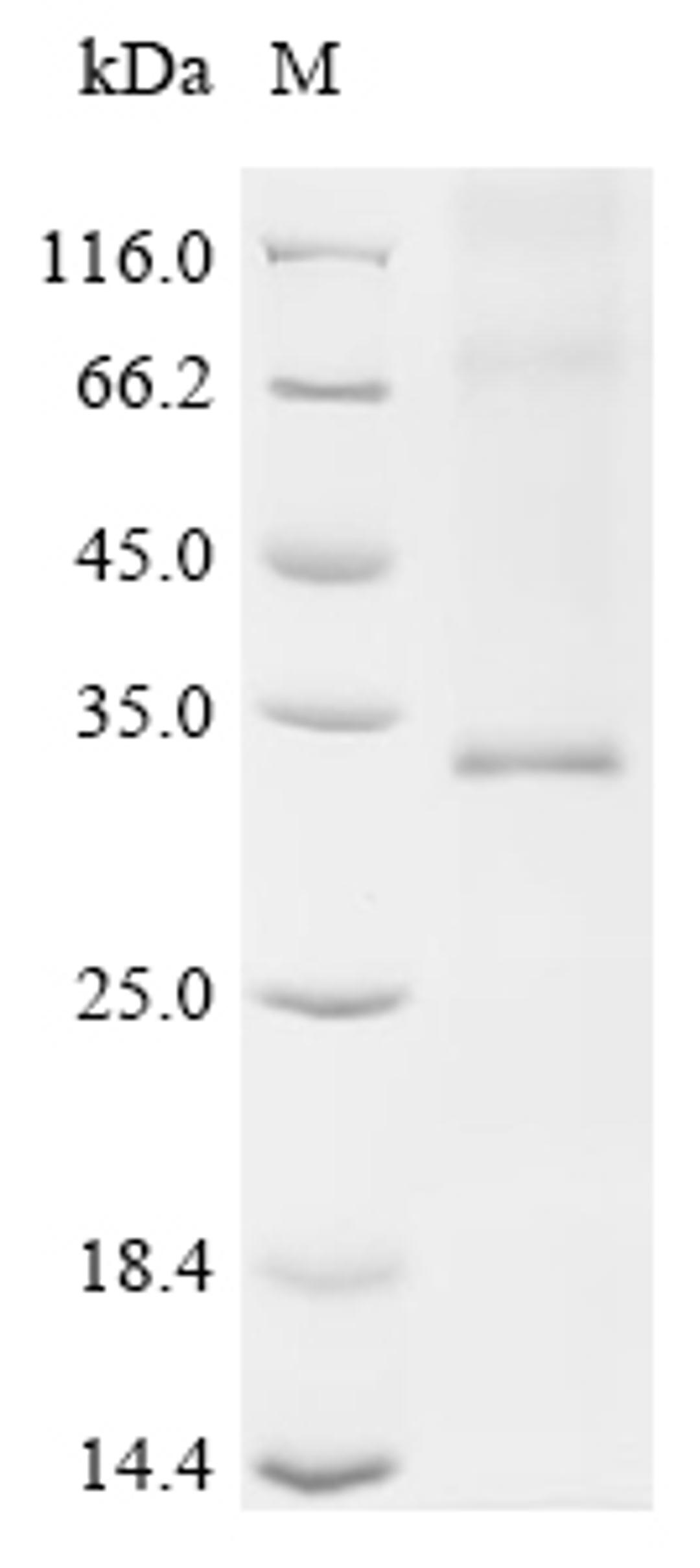 (Tris-Glycine gel) Discontinuous SDS-PAGE (reduced) with 5% enrichment gel and 15% separation gel.