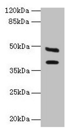 Western blot. All lanes: CA12 antibody at 6µg/ml + Mouse kidney tissue. Secondary. Goat polyclonal to rabbit IgG at 1/10000 dilution. Predicted band size: 40, 39 kDa. Observed band size: 40, 48 kDa